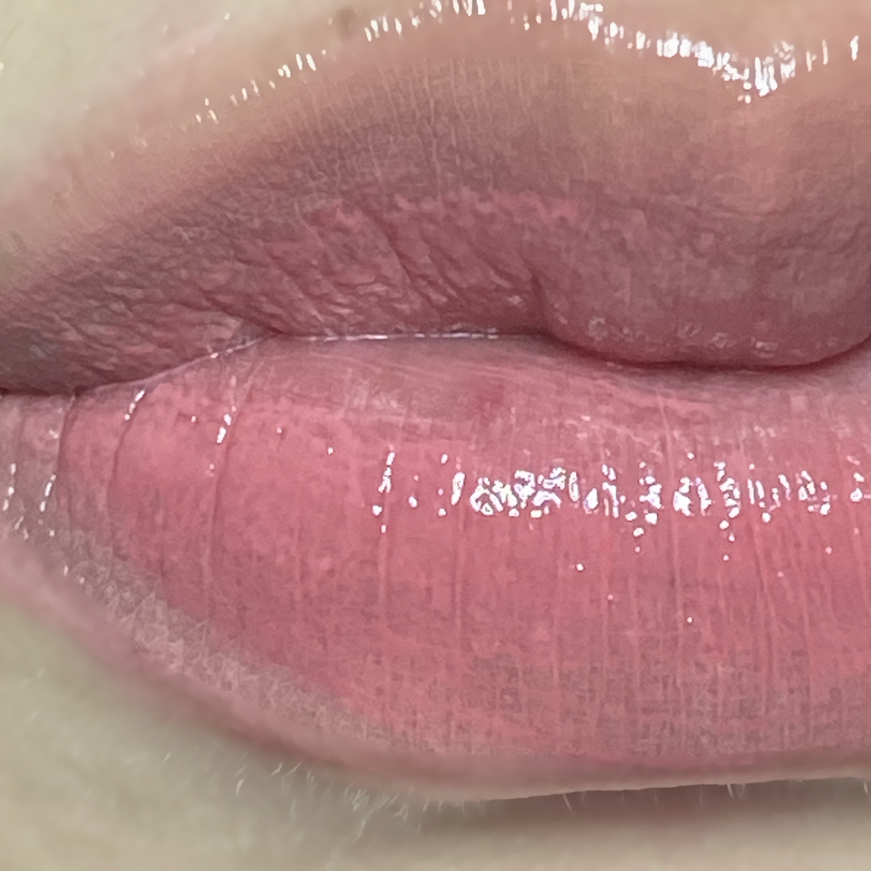 피드이미지정보-1