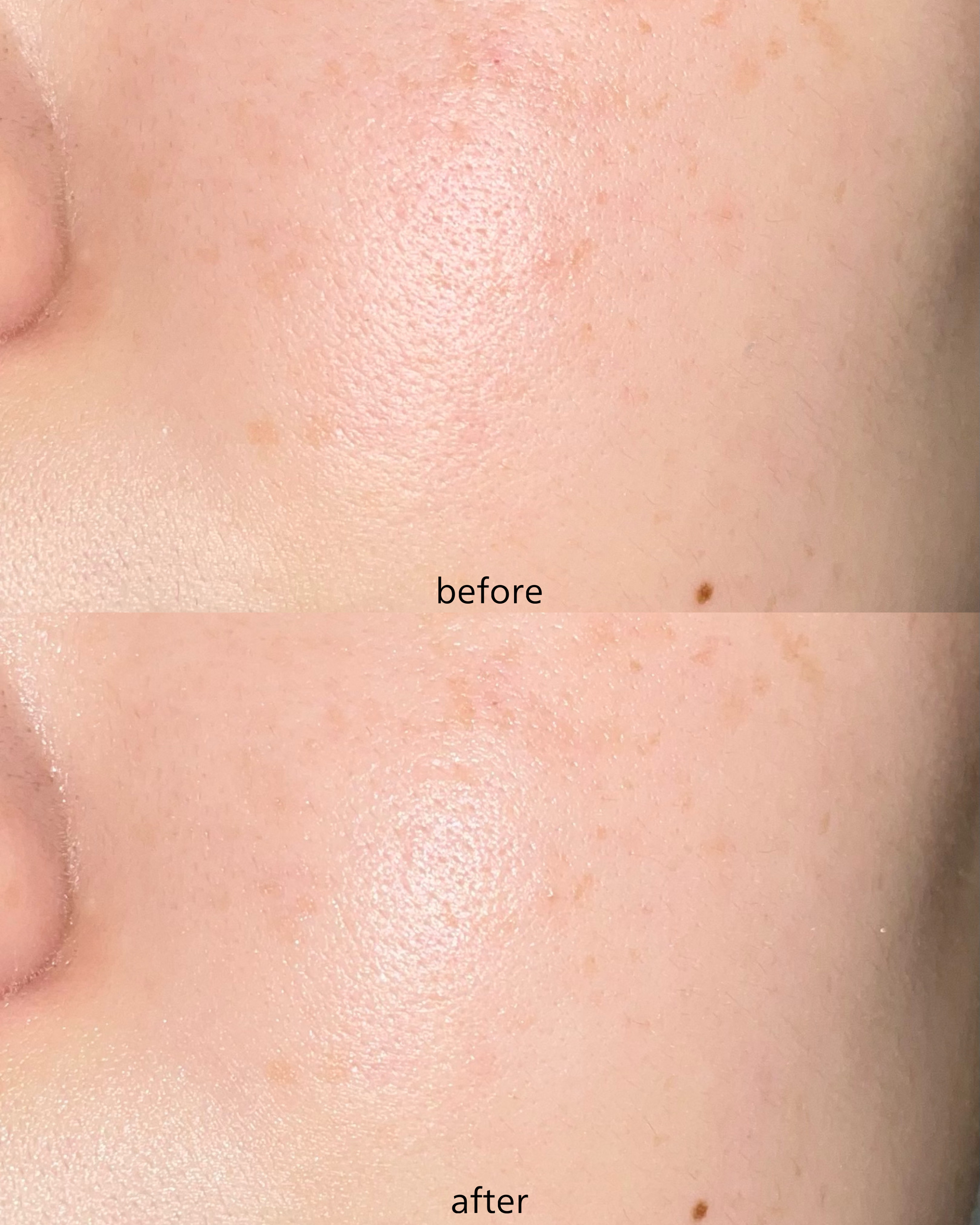 피드이미지정보-2