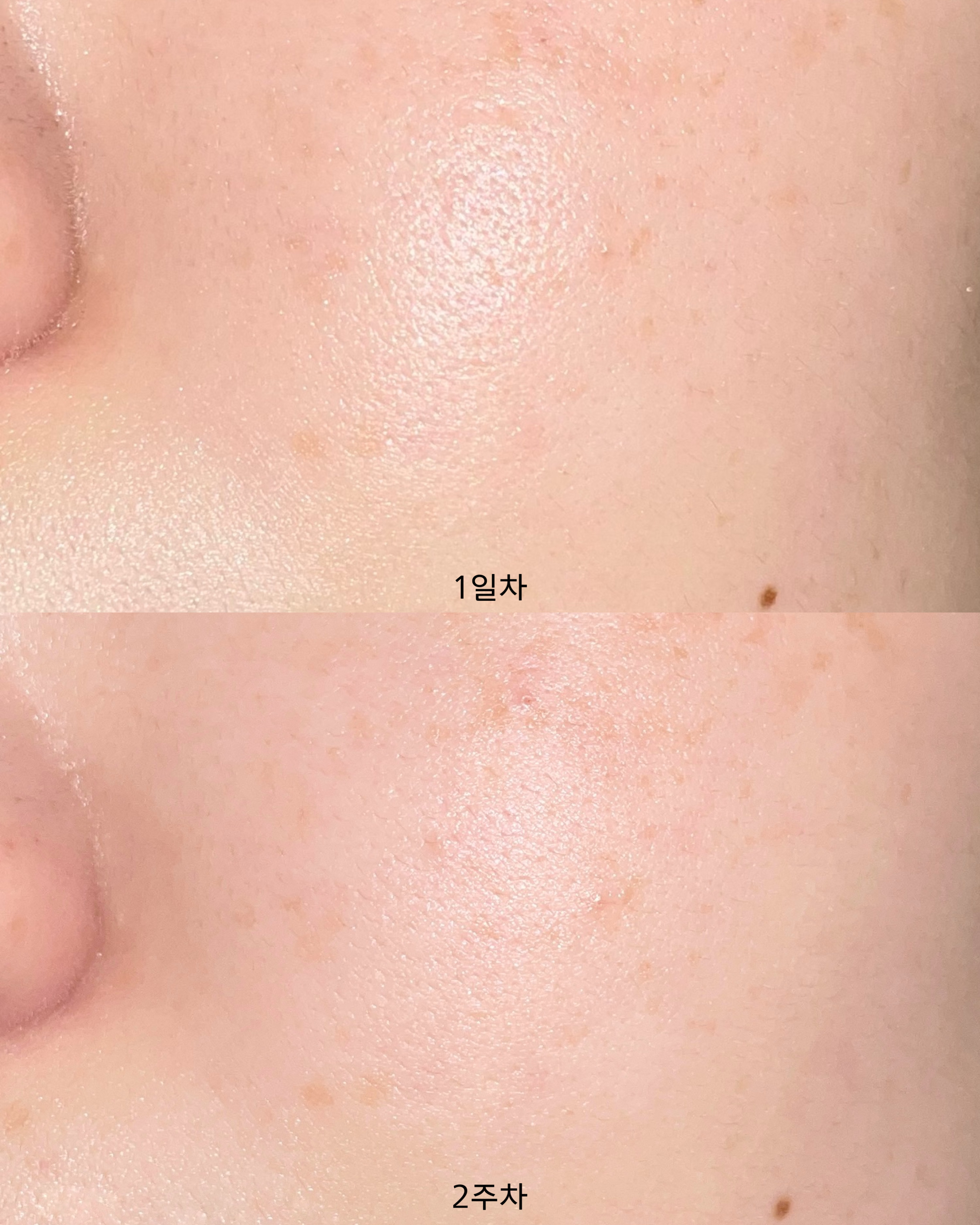 피드이미지정보-3