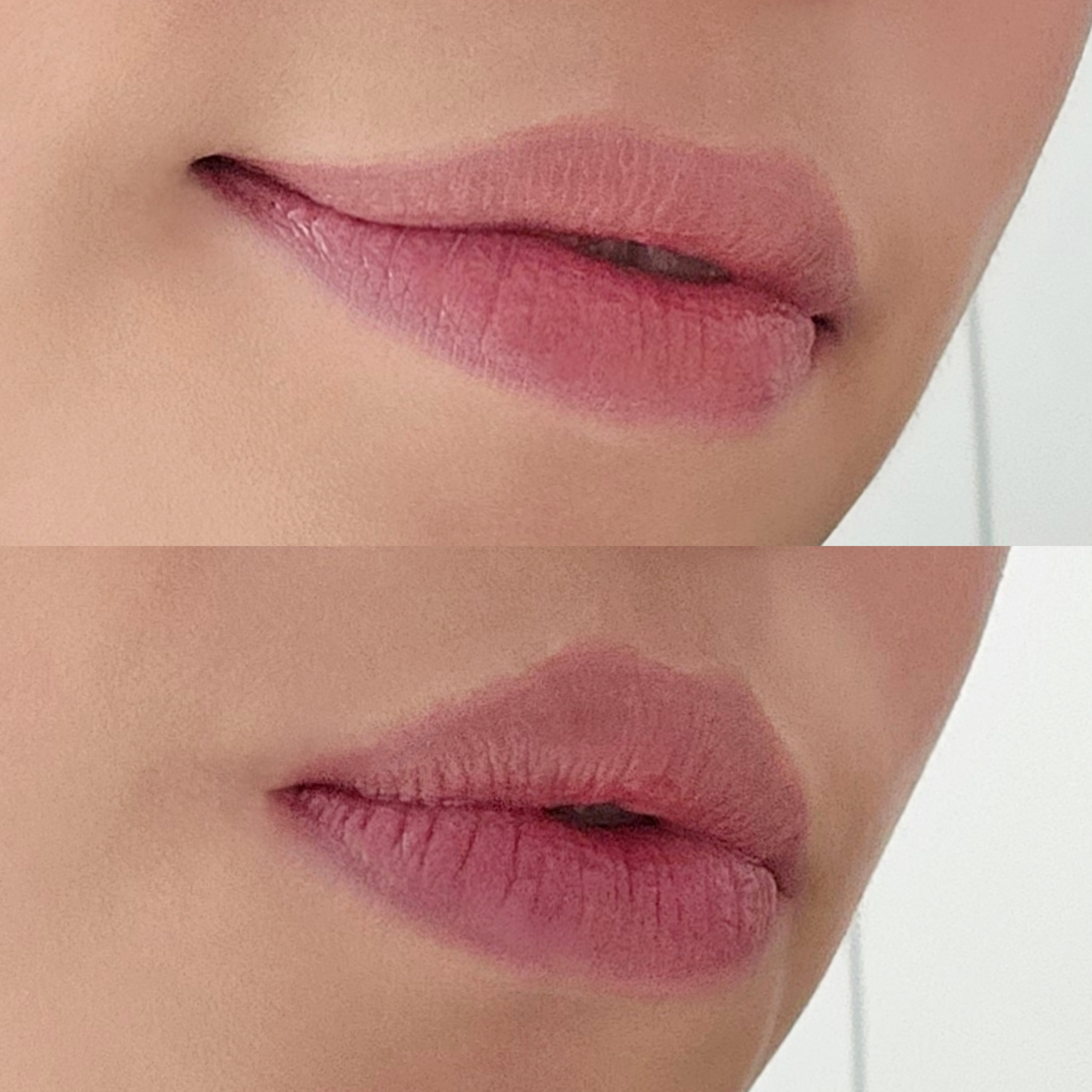 피드이미지정보-5