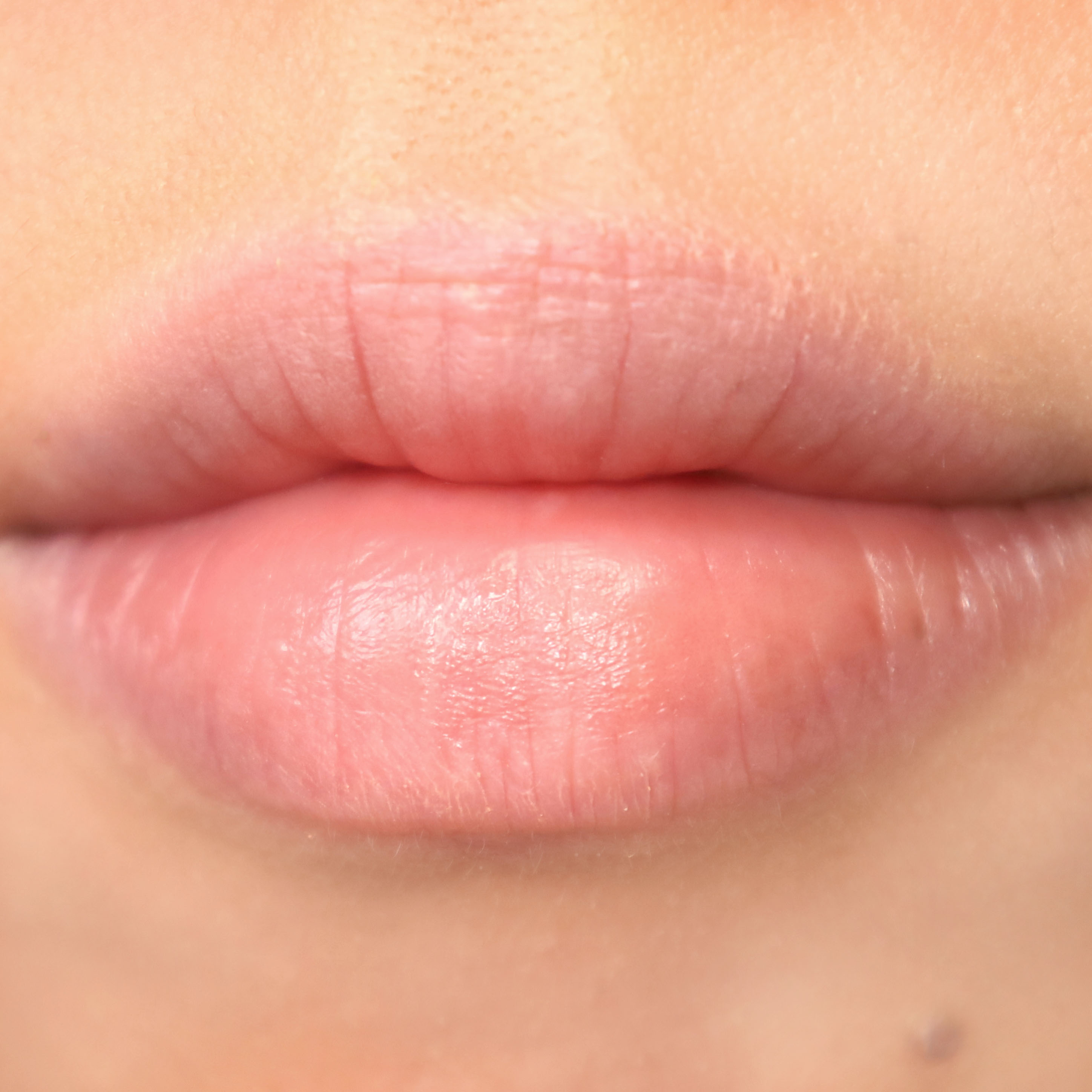 피드이미지정보-6