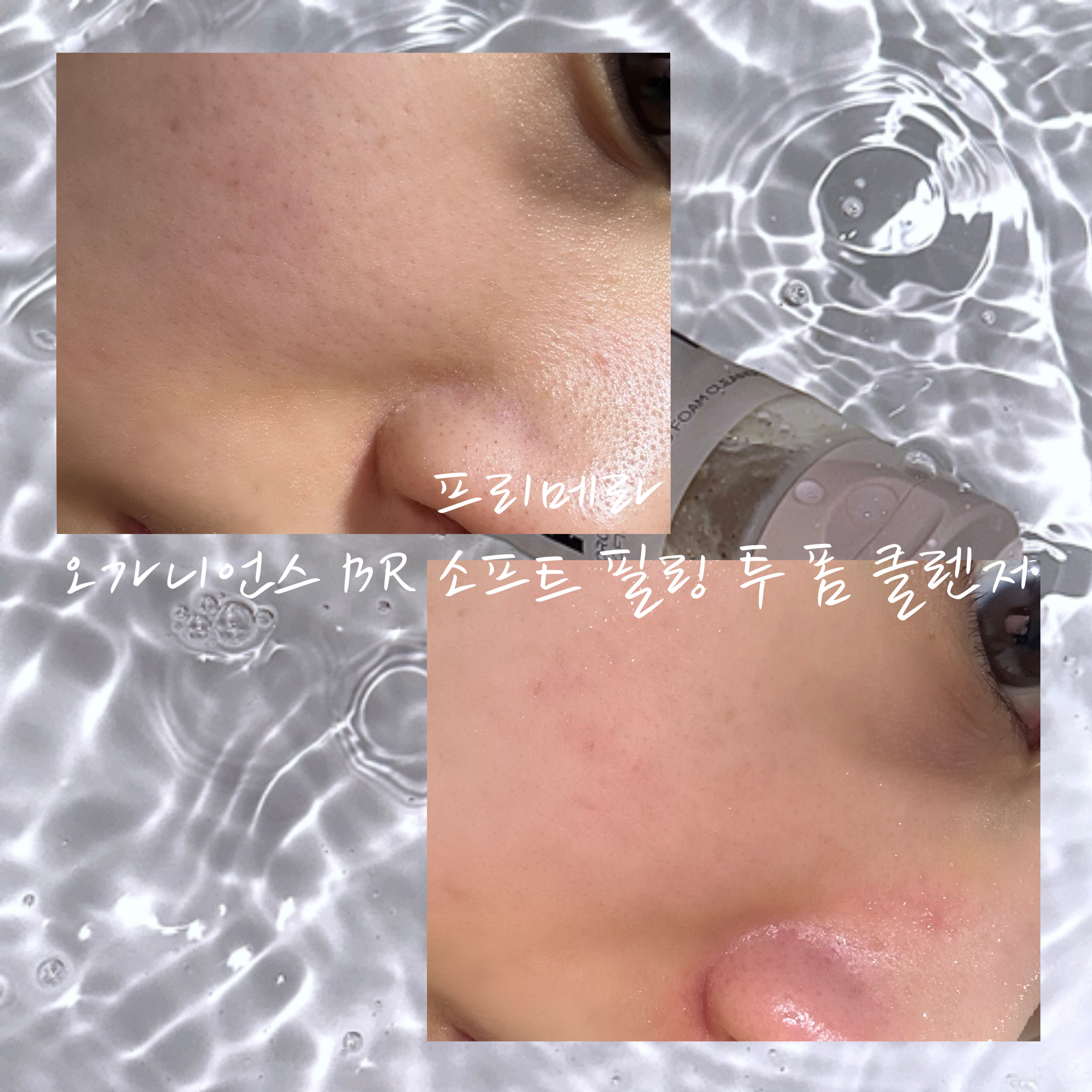 피드이미지정보-2