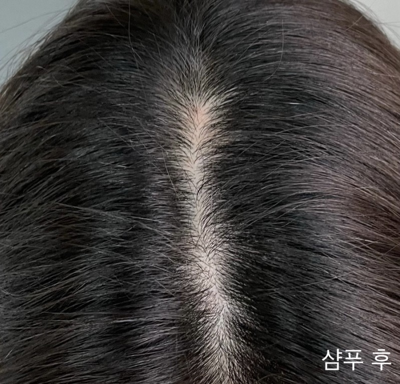 피드이미지정보-4