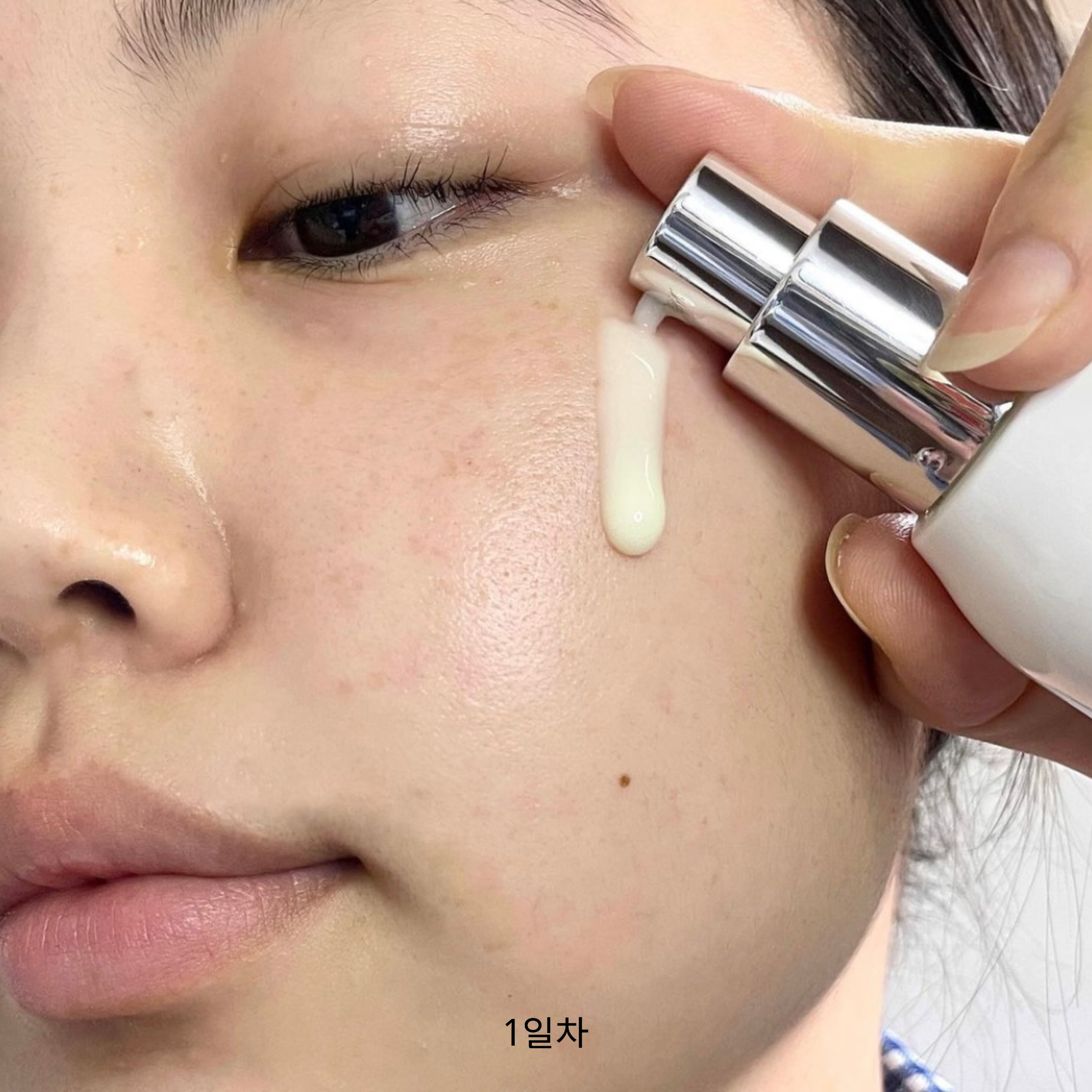 피드이미지정보-1