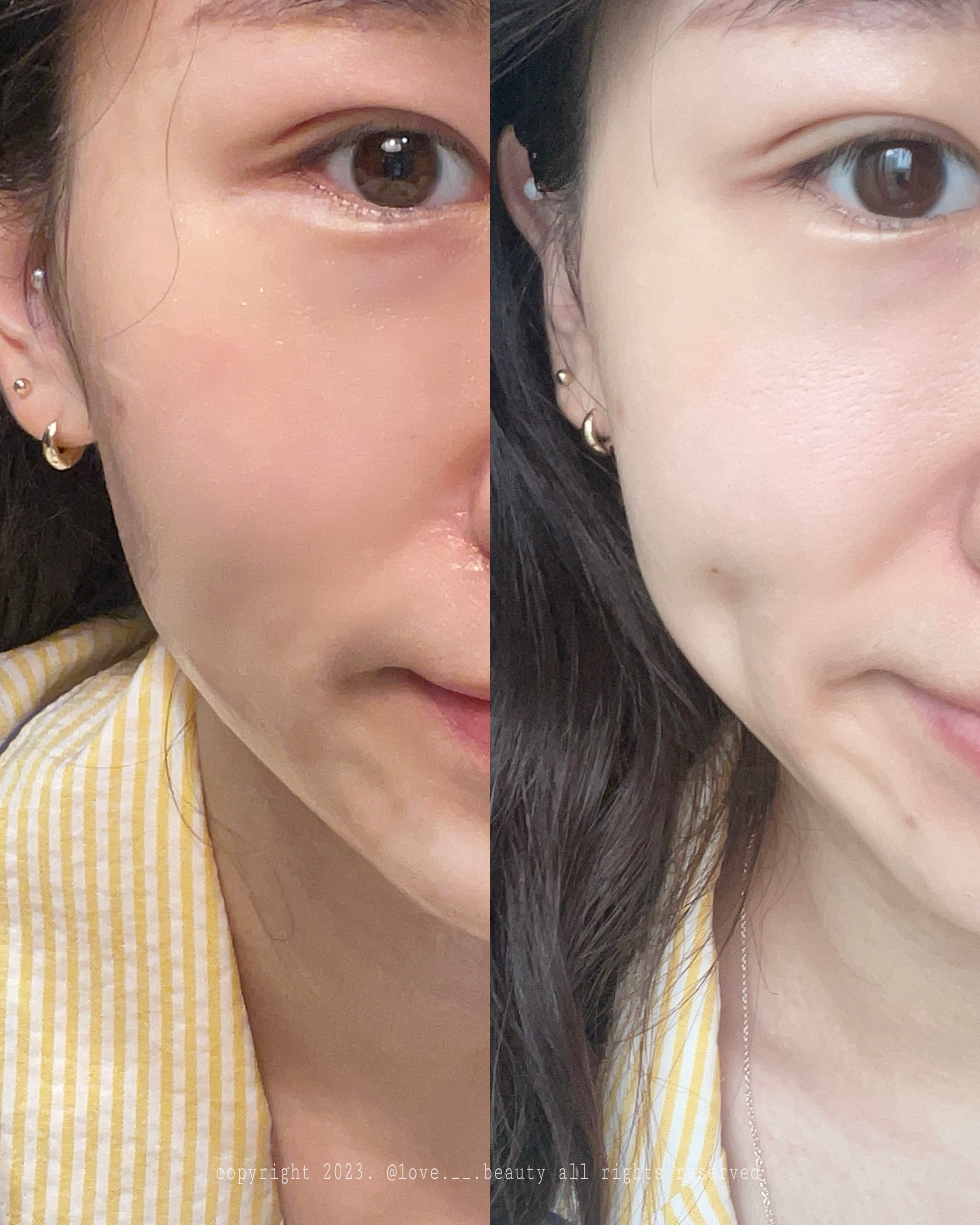 피드이미지정보-3