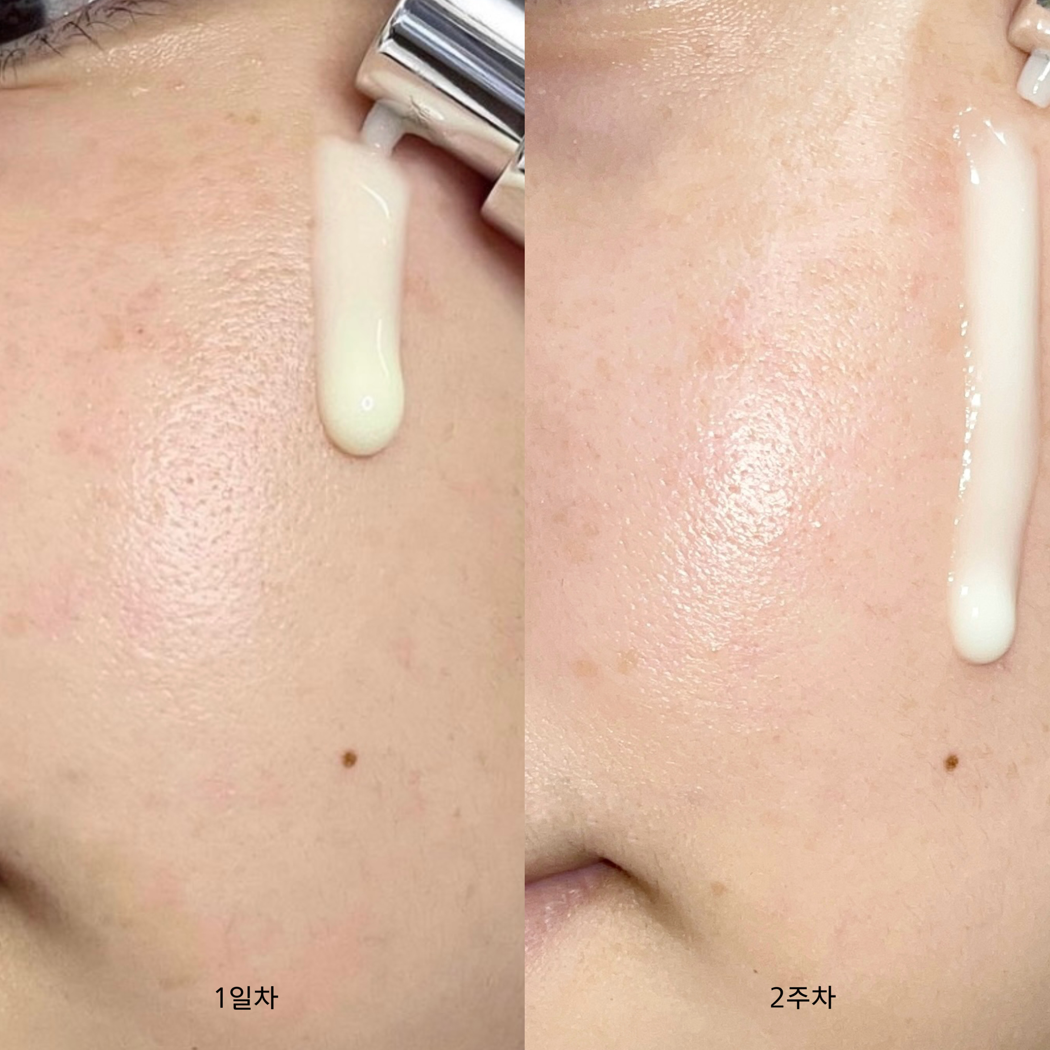 피드이미지정보-3