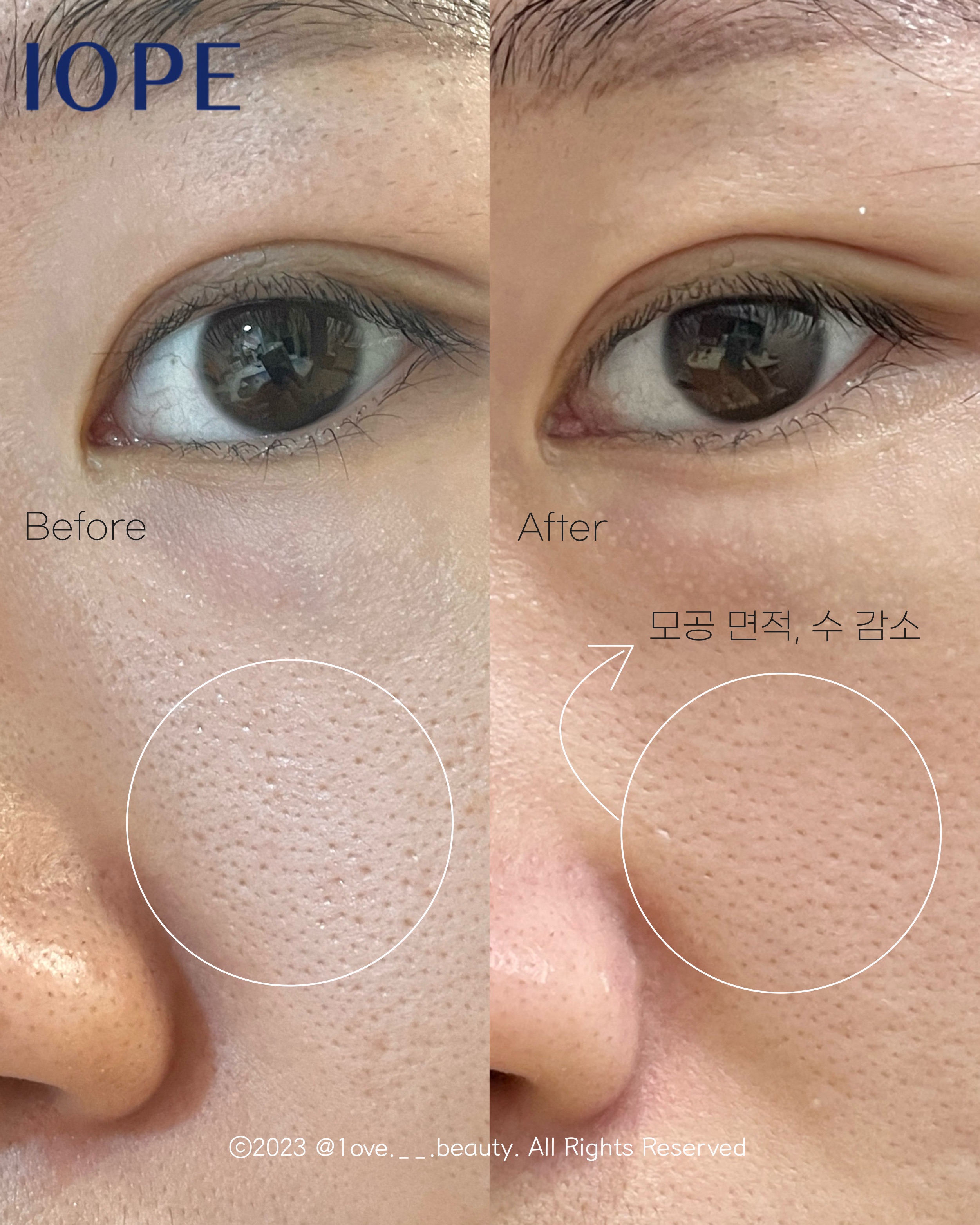 피드이미지정보-1