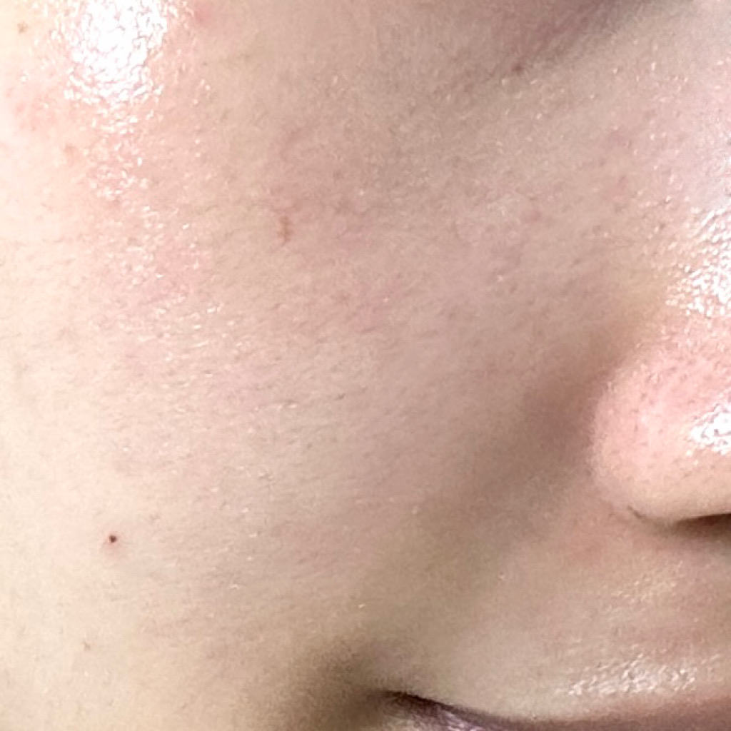 피드이미지정보-4