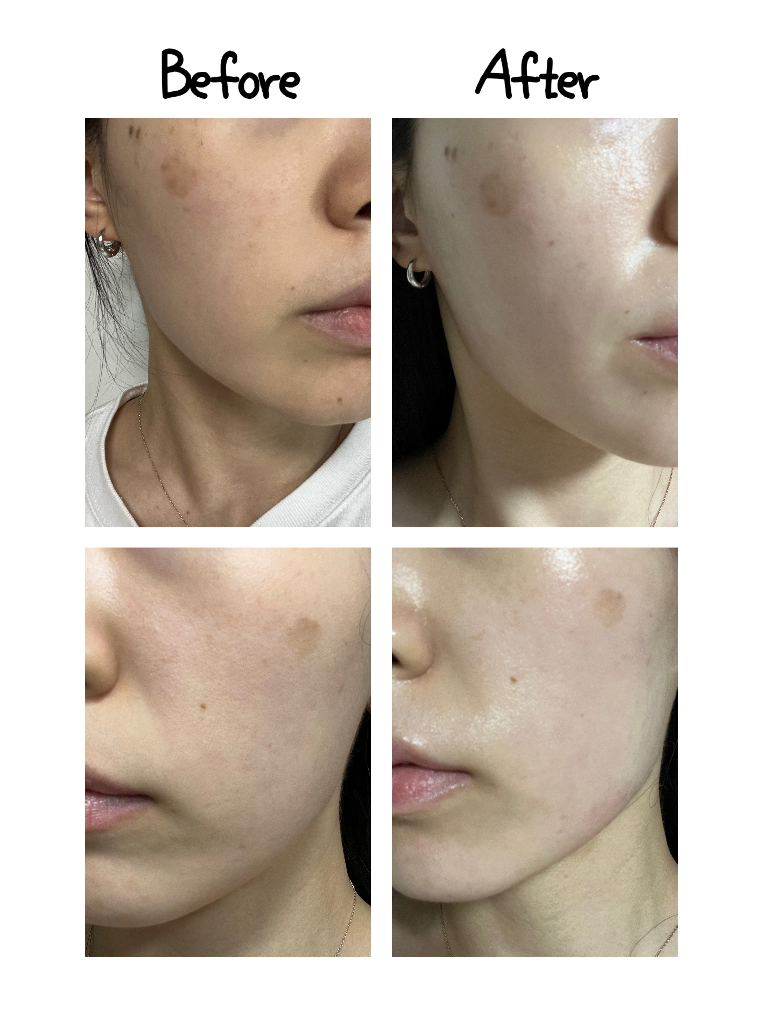 피드이미지정보-1