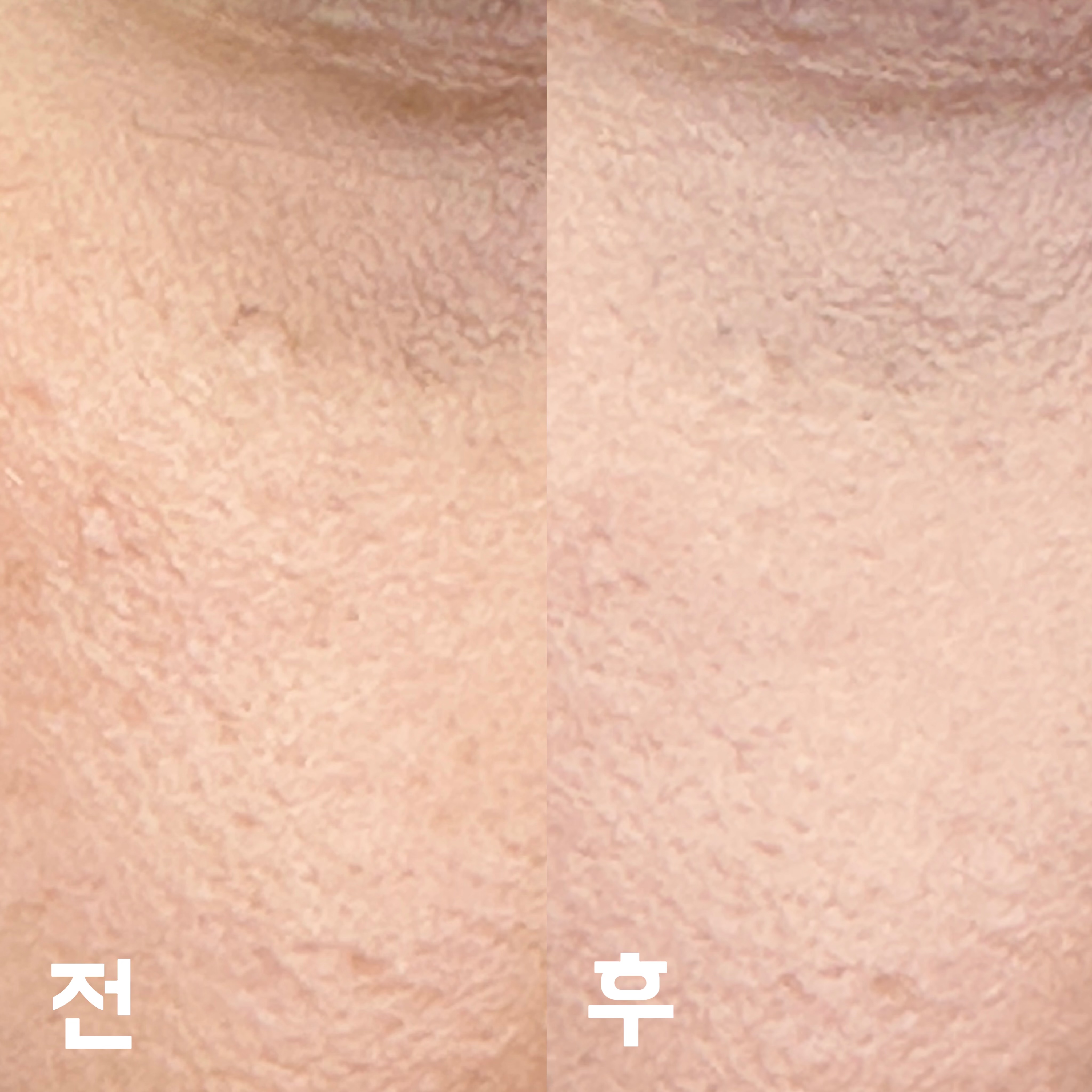 피드이미지정보-3