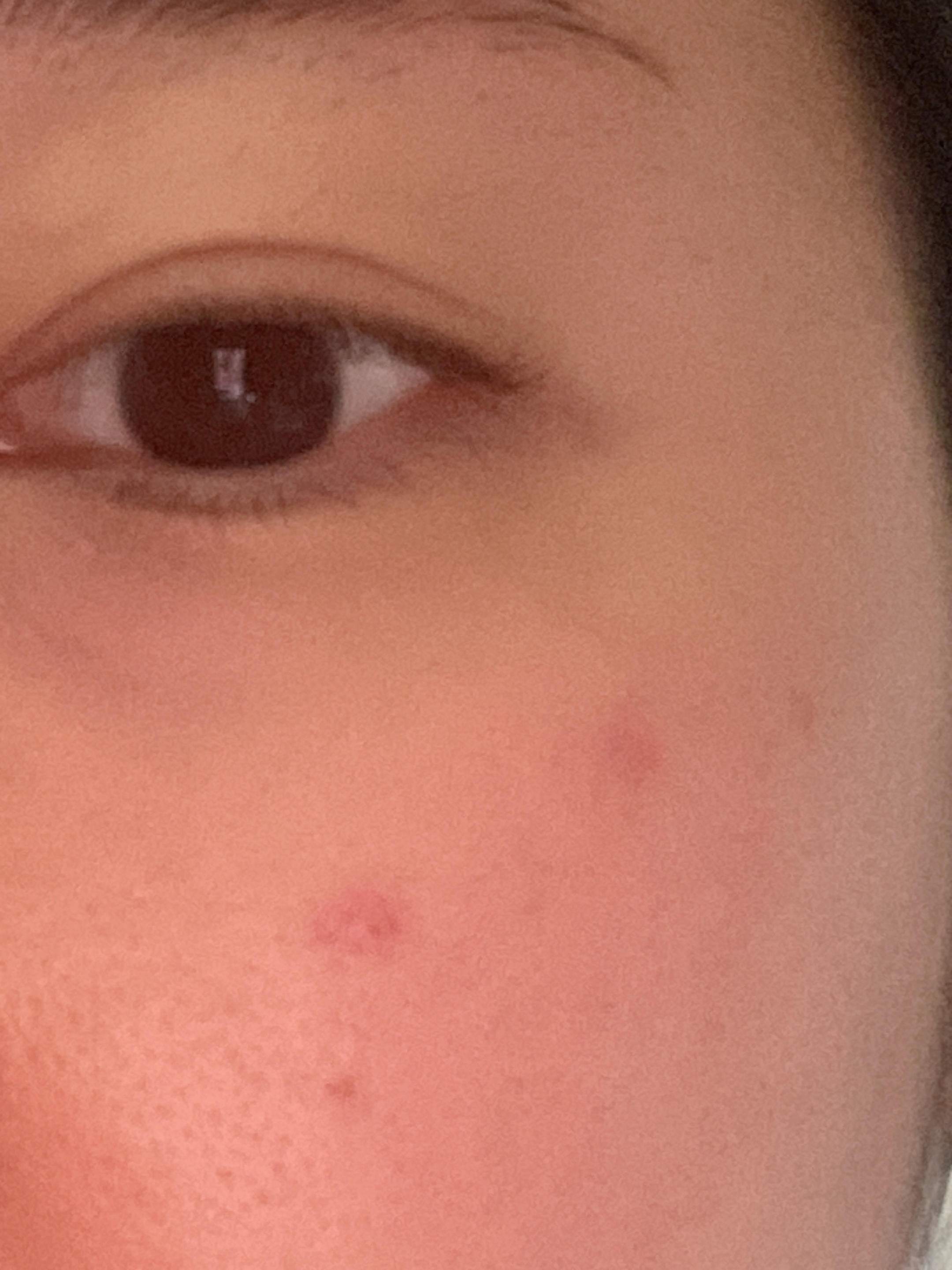 피드이미지정보-2