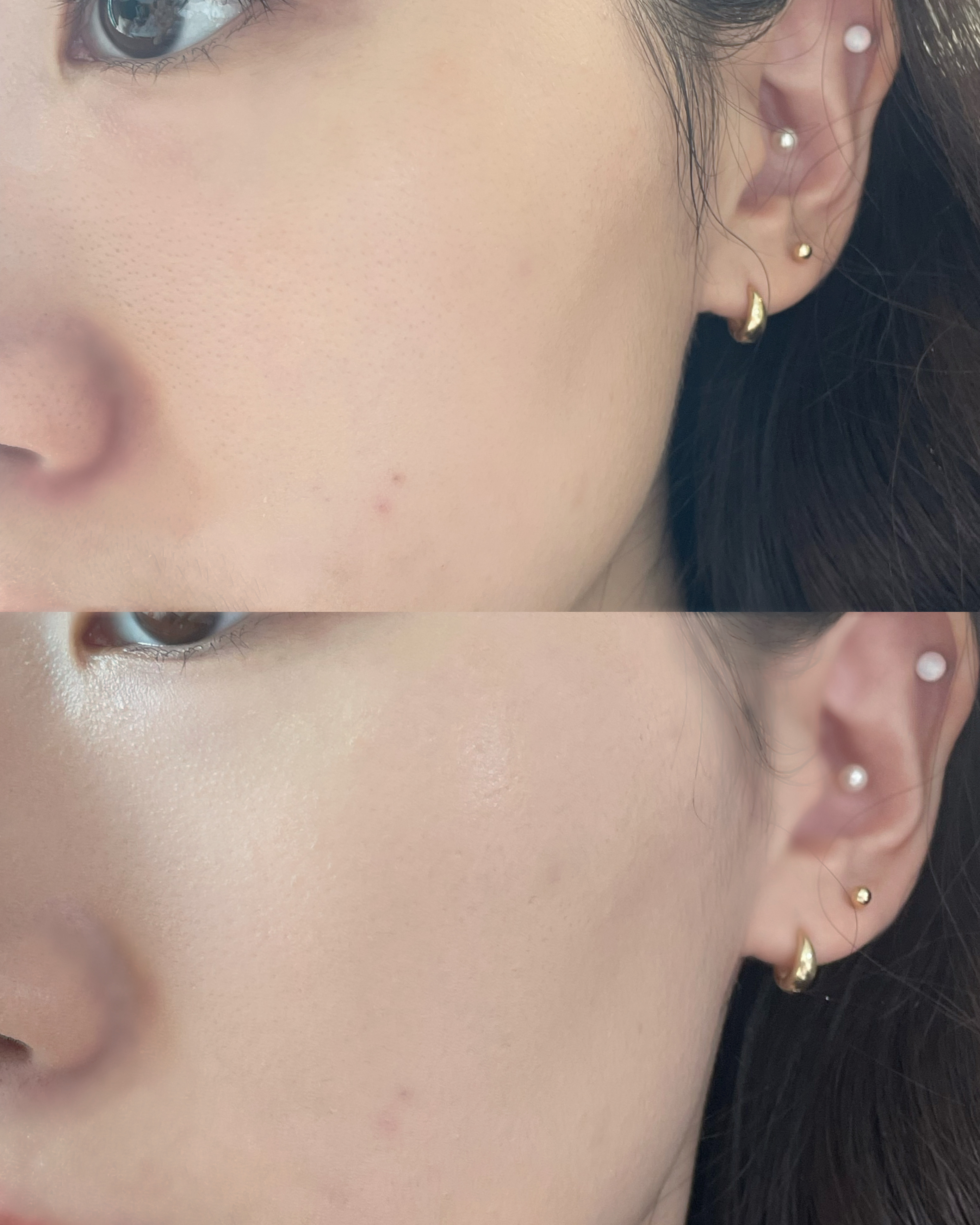 피드이미지정보-0