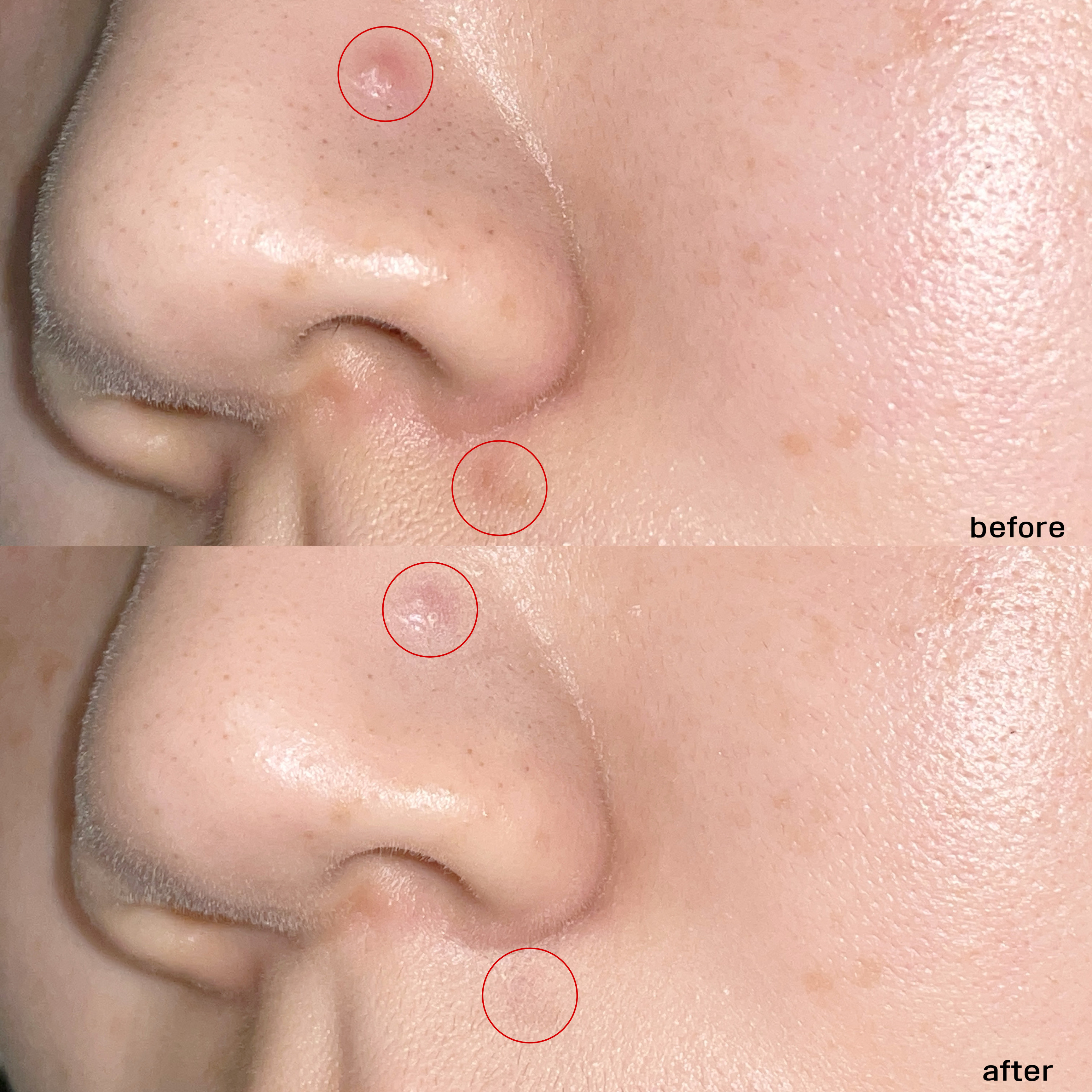 피드이미지정보-2