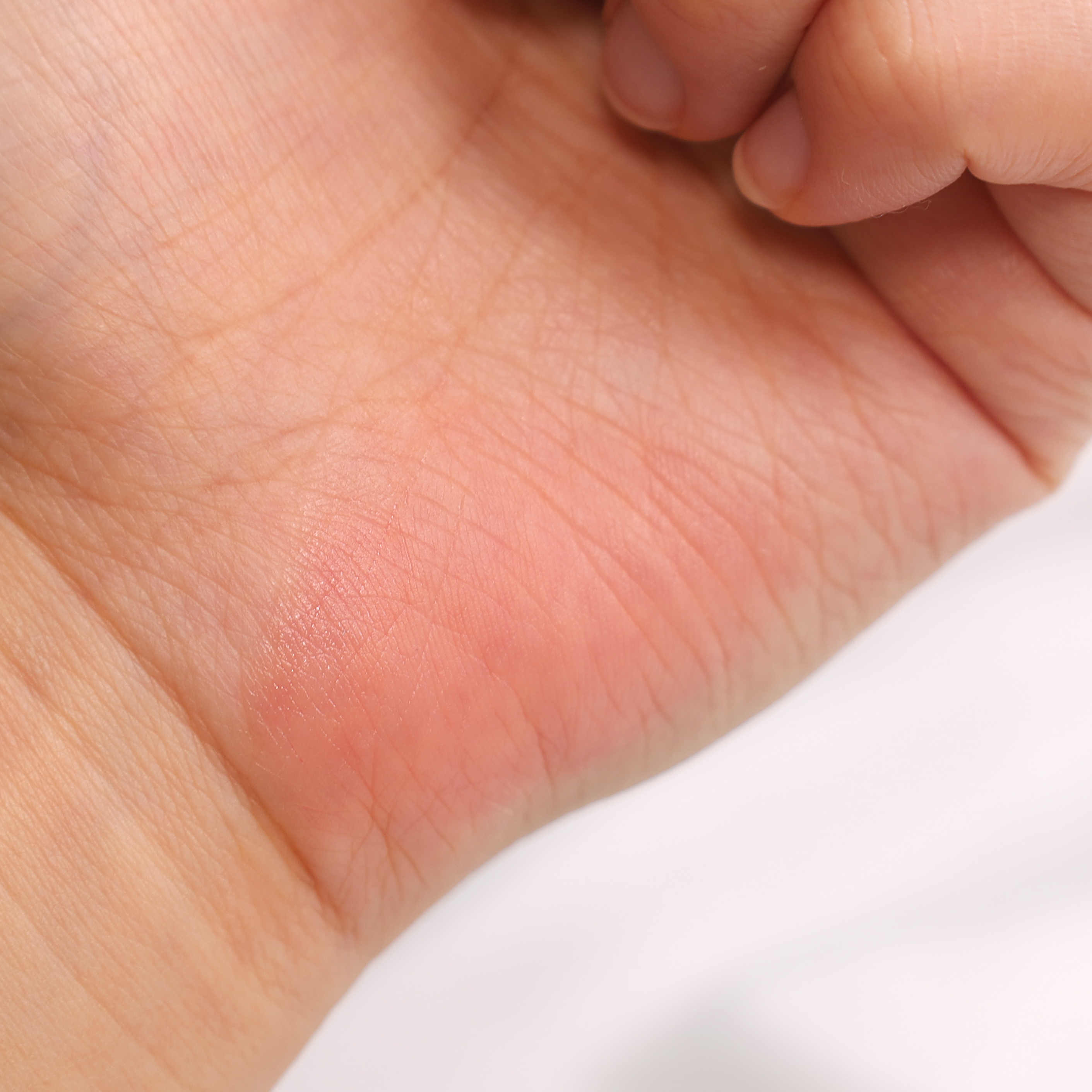 피드이미지정보-3