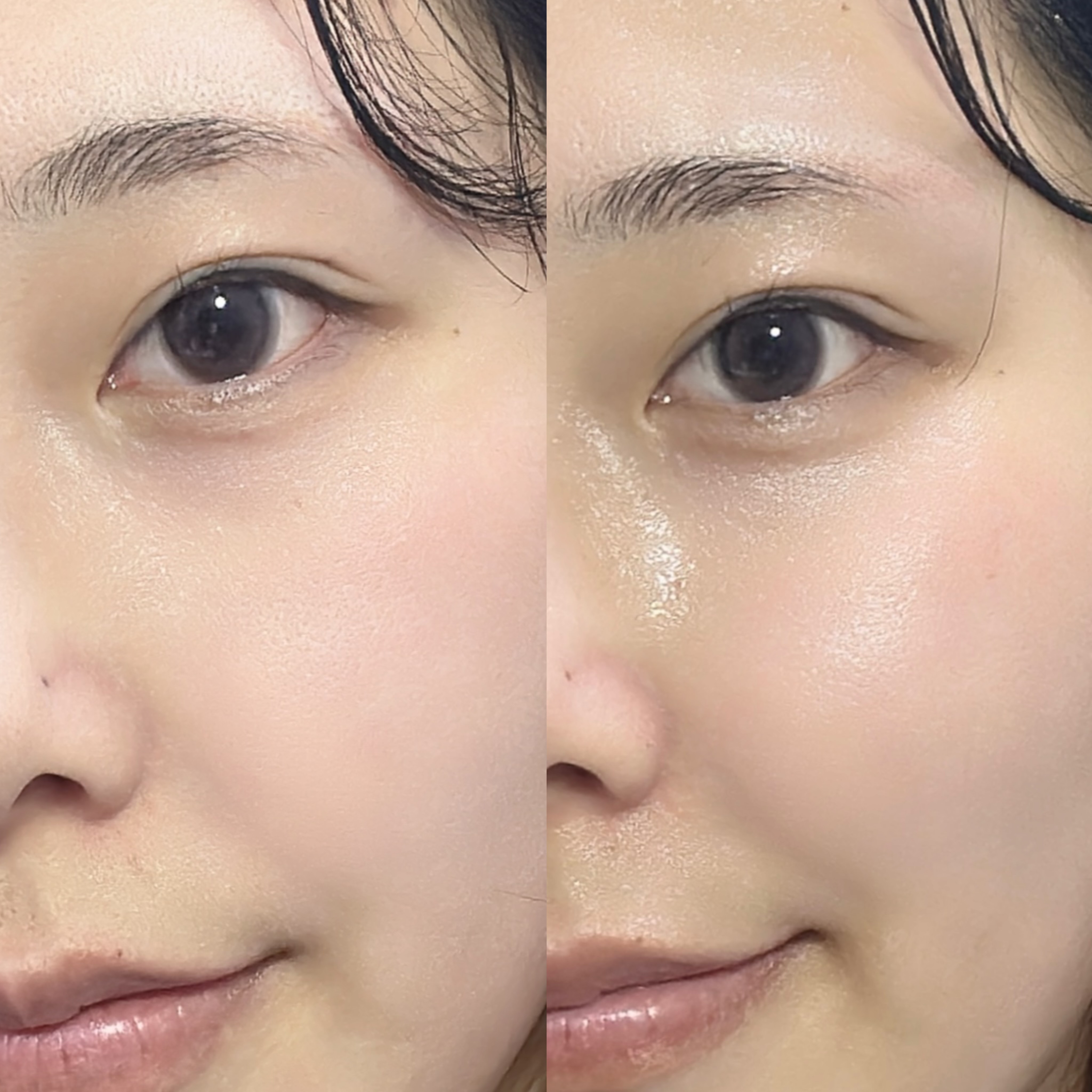 피드이미지정보-3