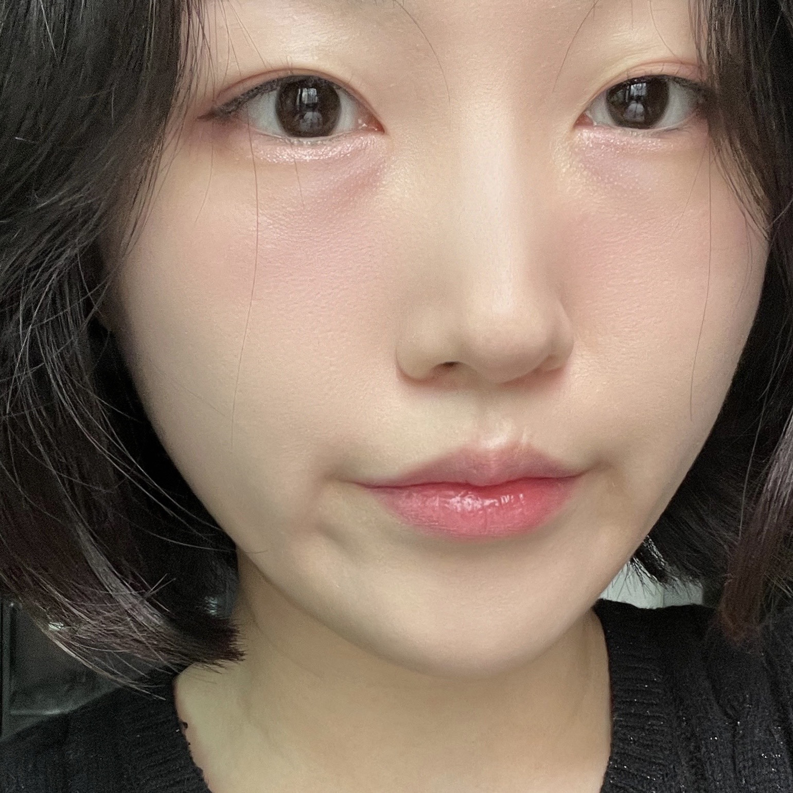 피드이미지정보-4