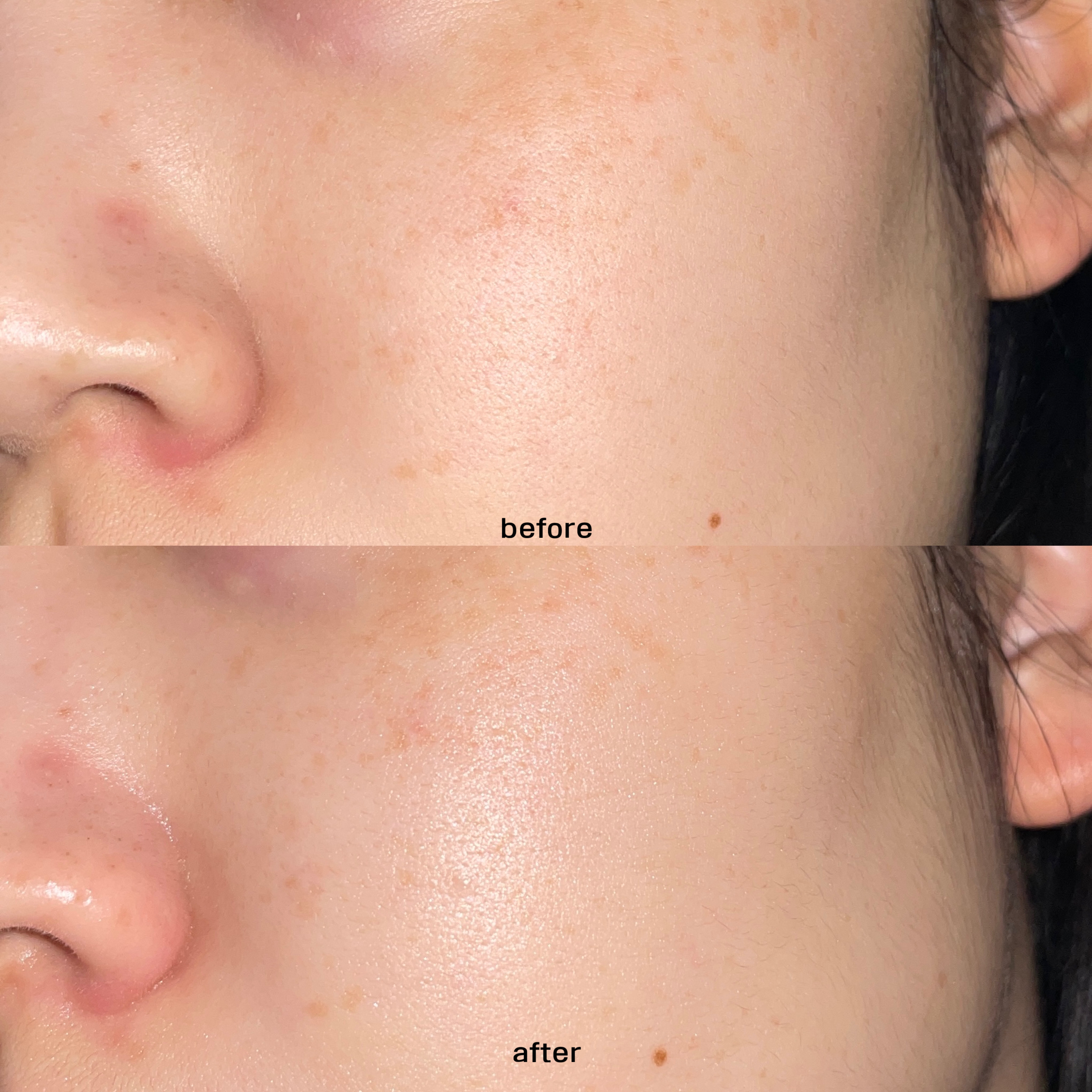 피드이미지정보-3