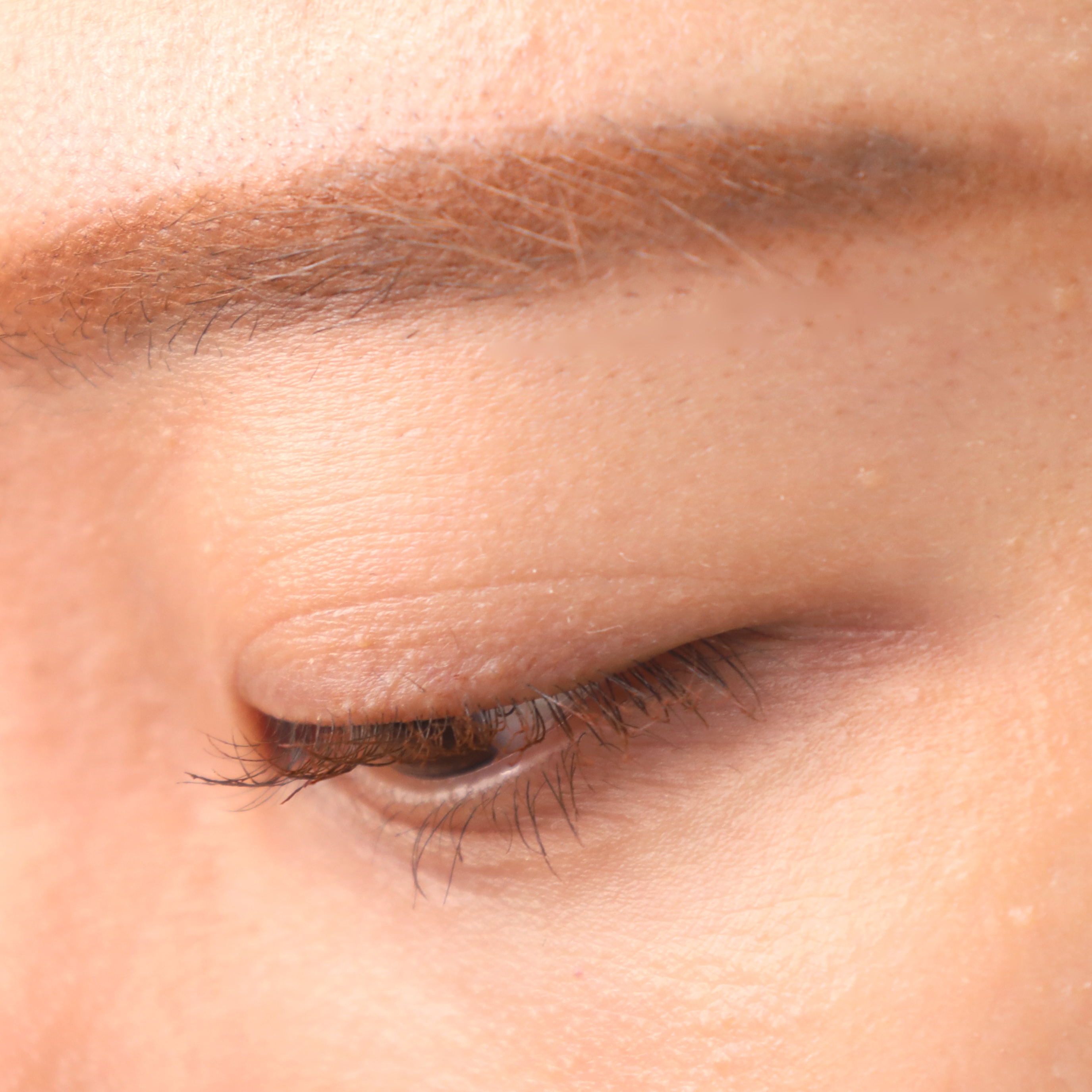 피드이미지정보-5