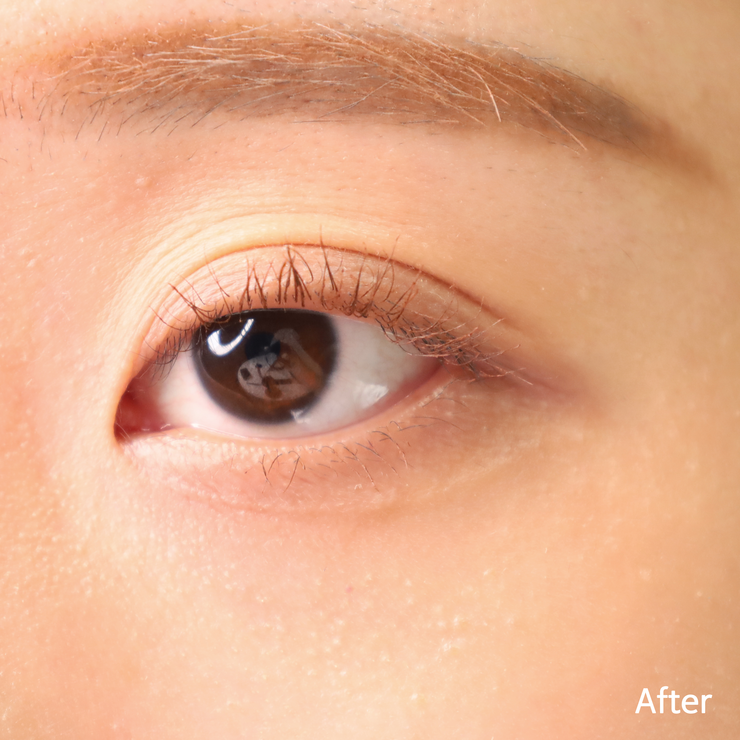 피드이미지정보-4