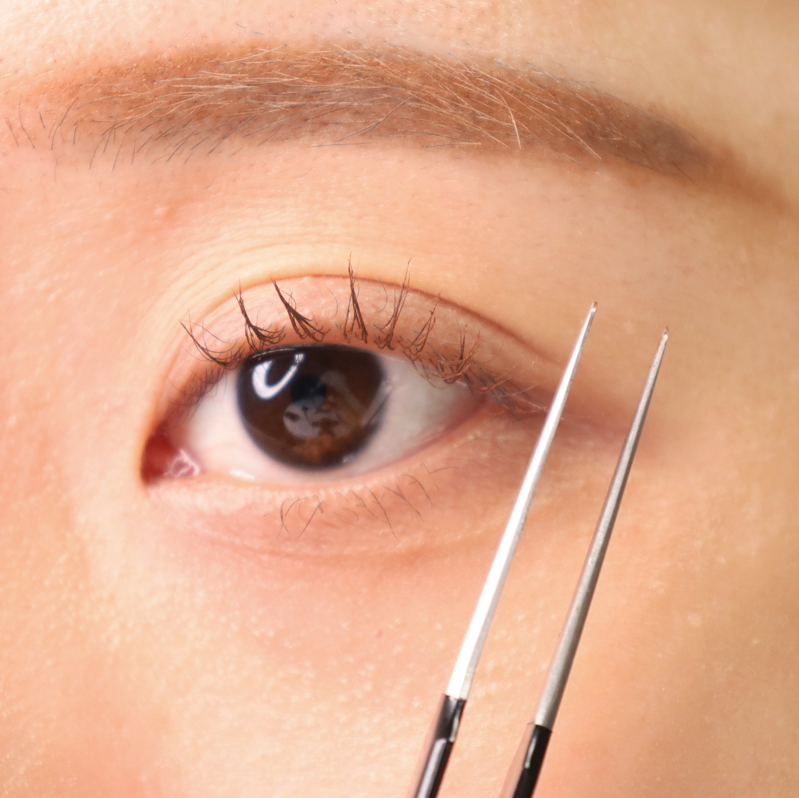 피드이미지정보-6