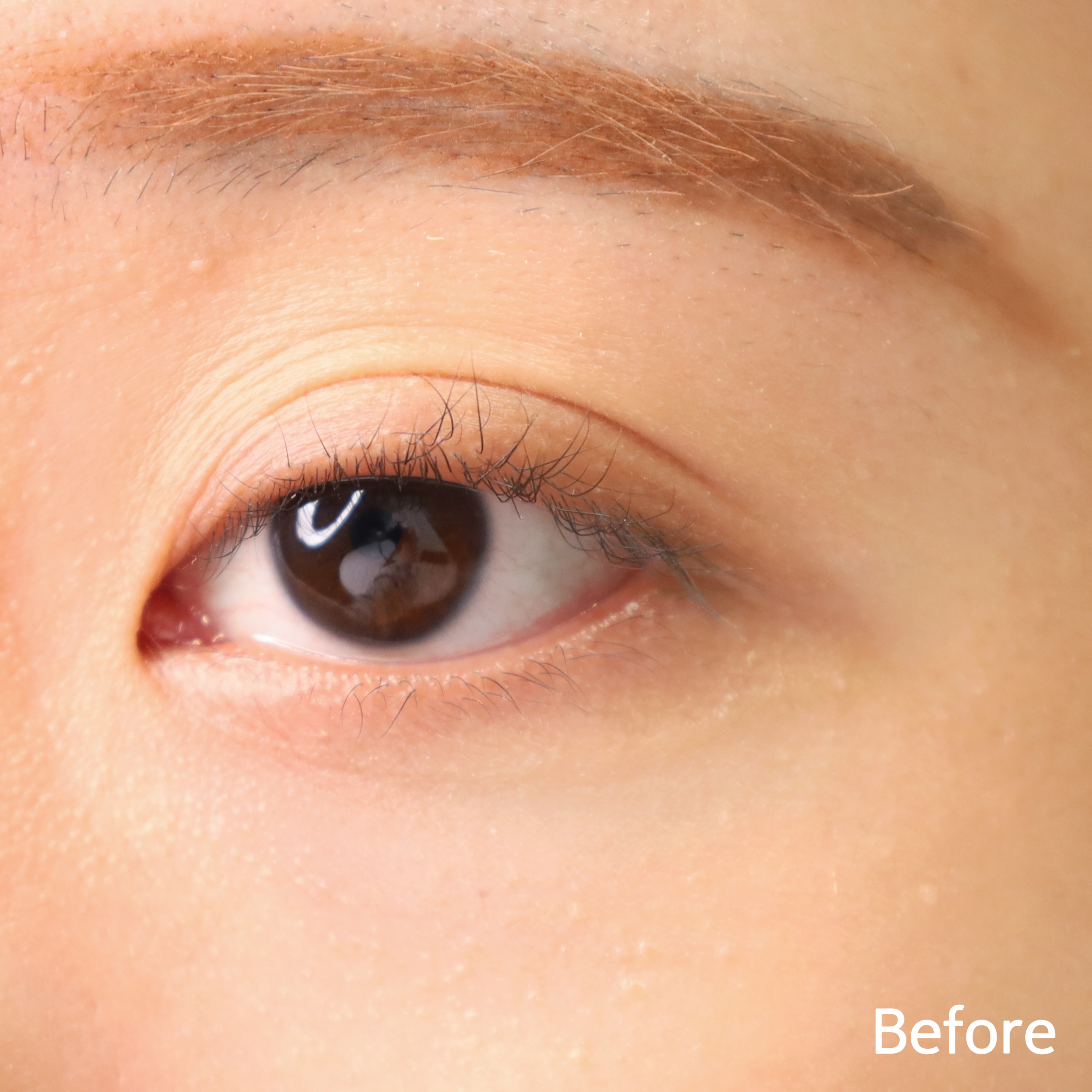 피드이미지정보-3