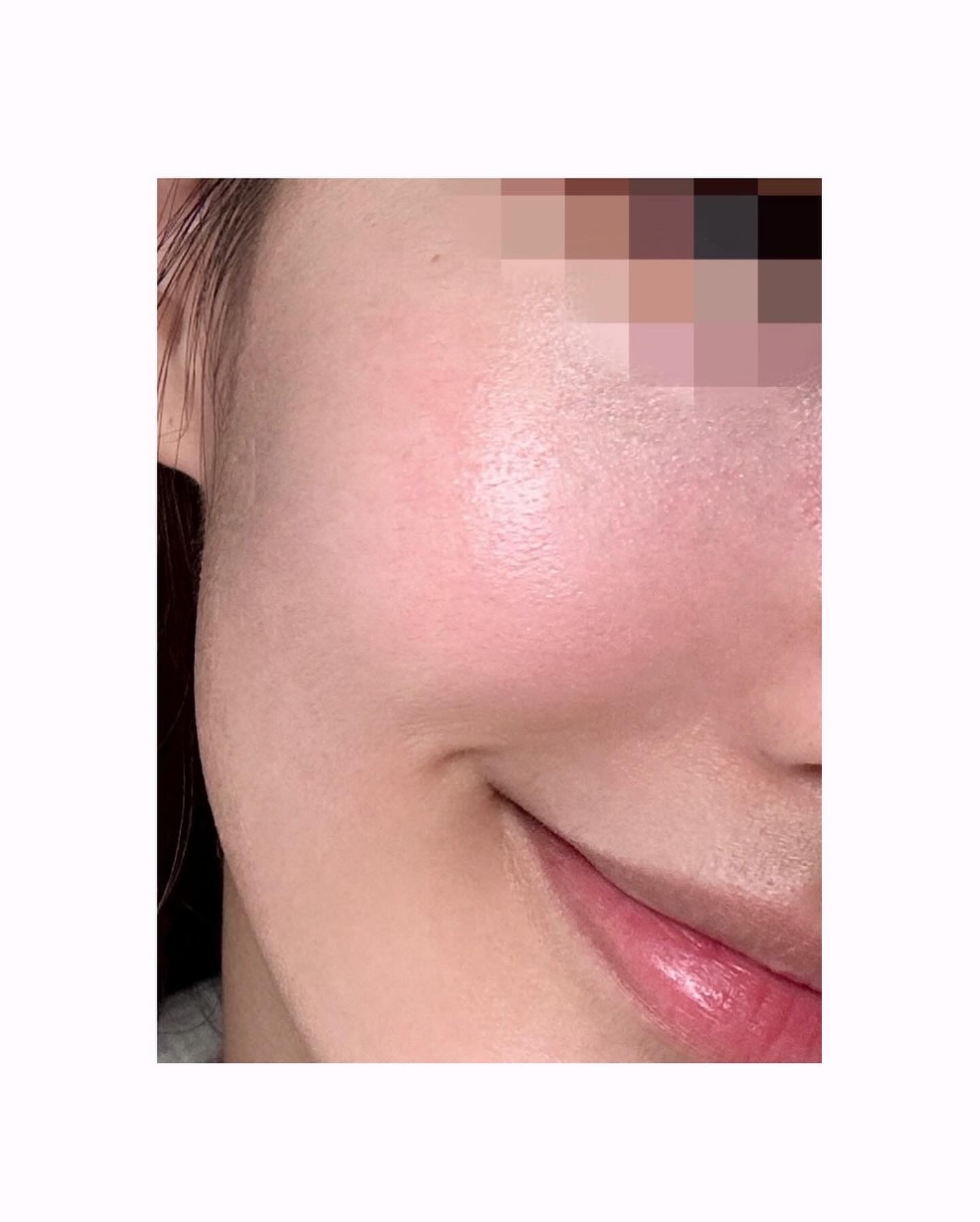 피드이미지정보-5