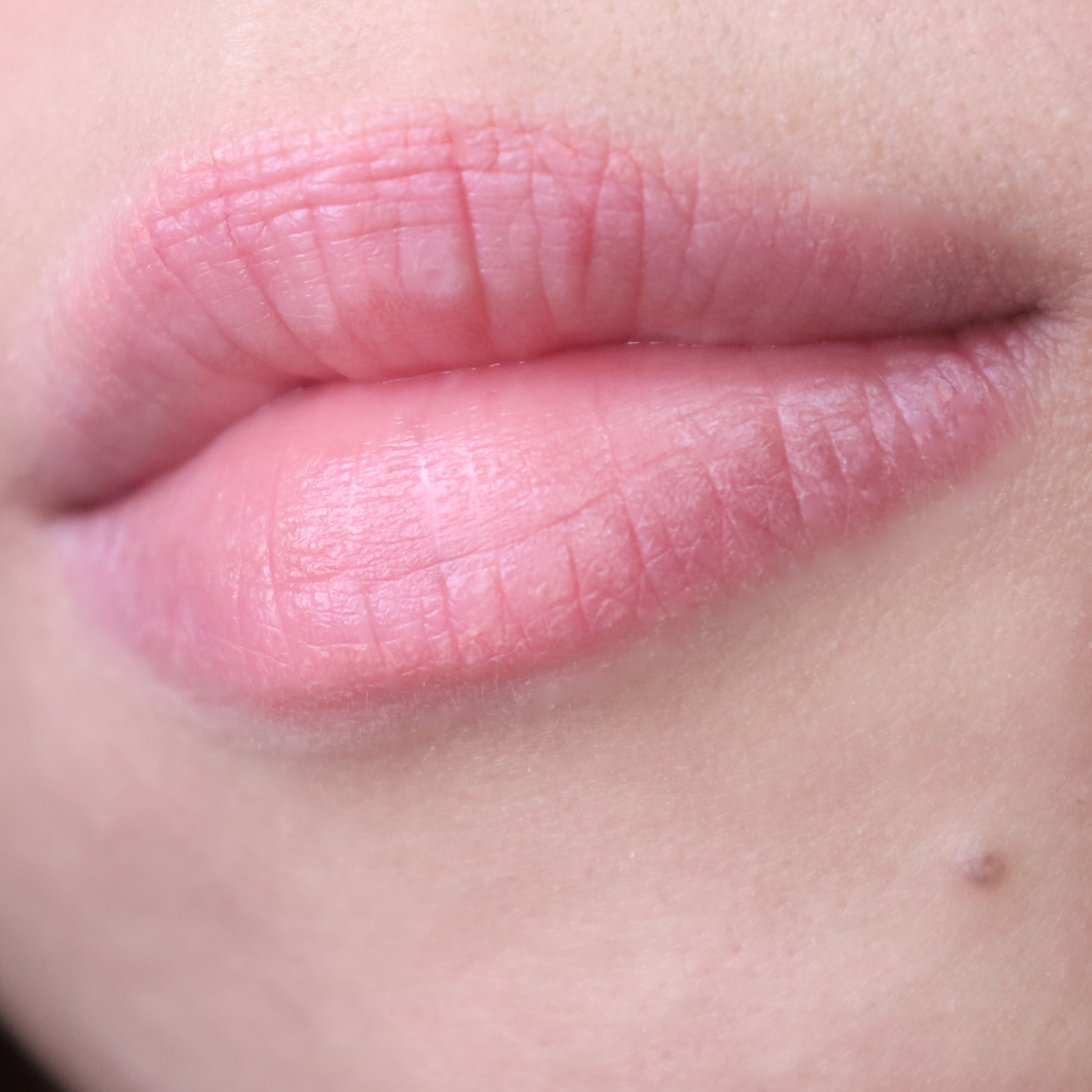 피드이미지정보-7