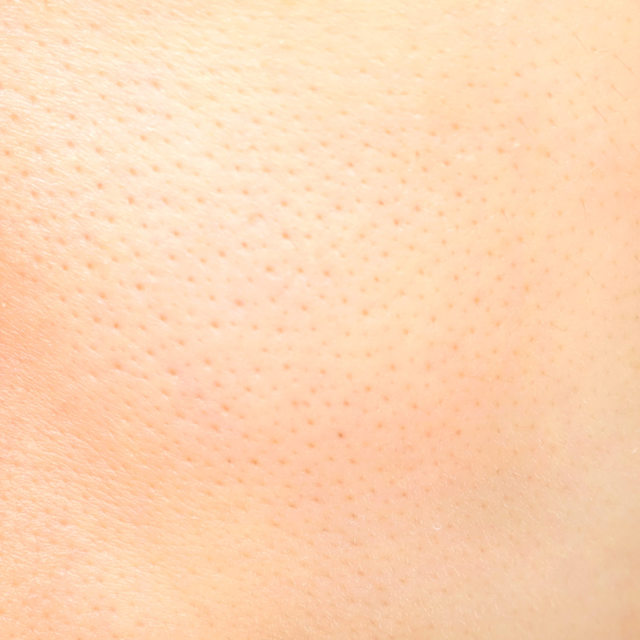 피드이미지정보-2