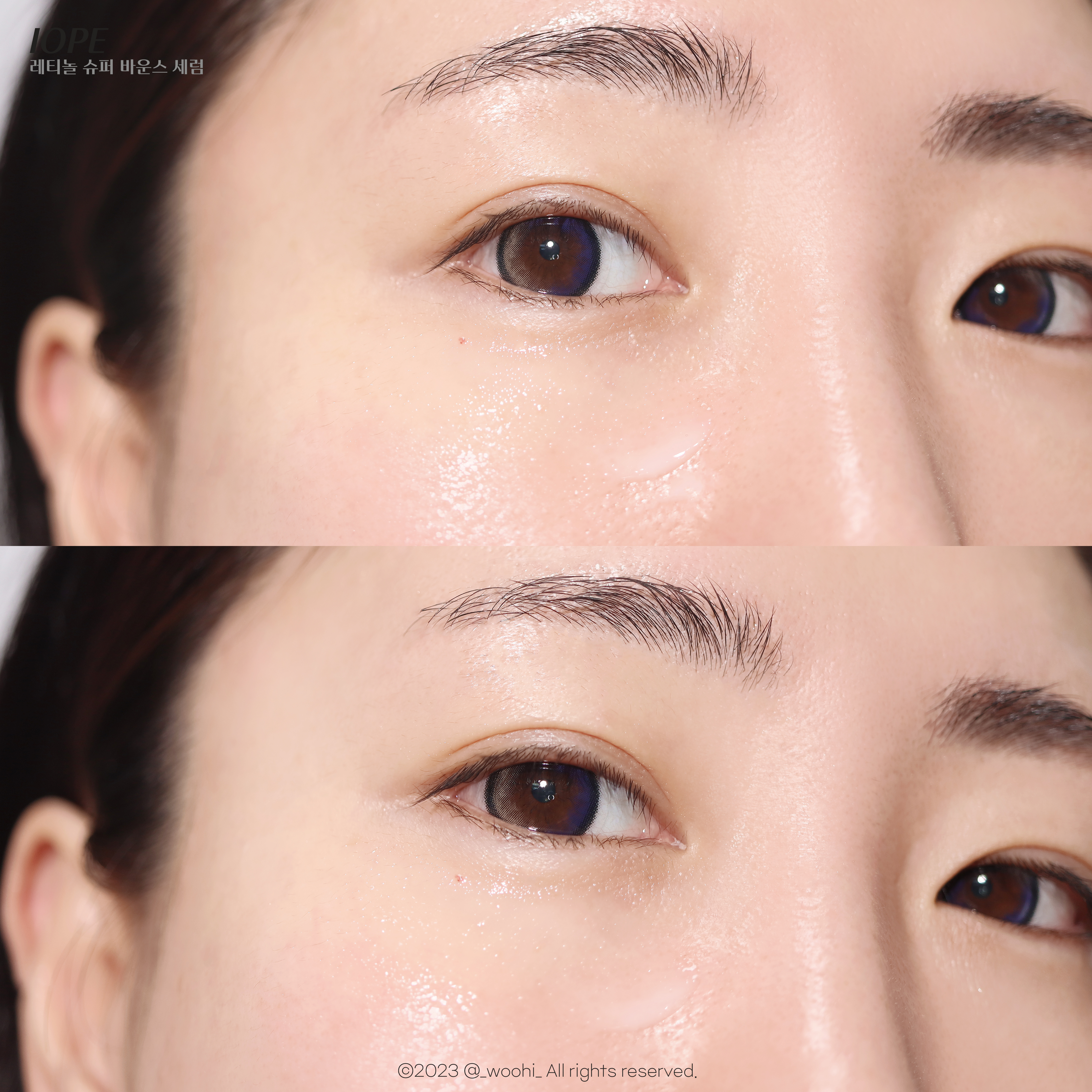 피드이미지정보-0