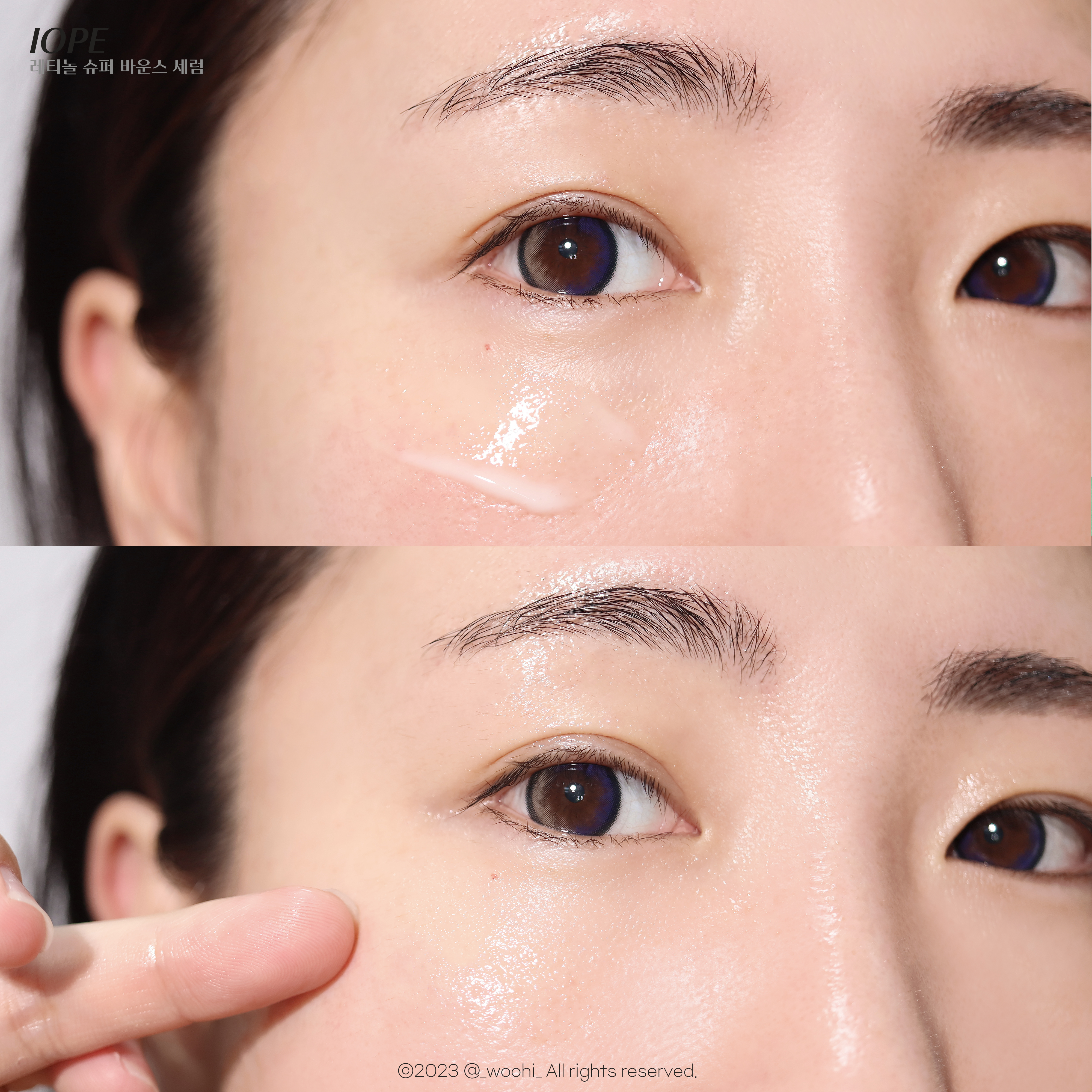 피드이미지정보-1