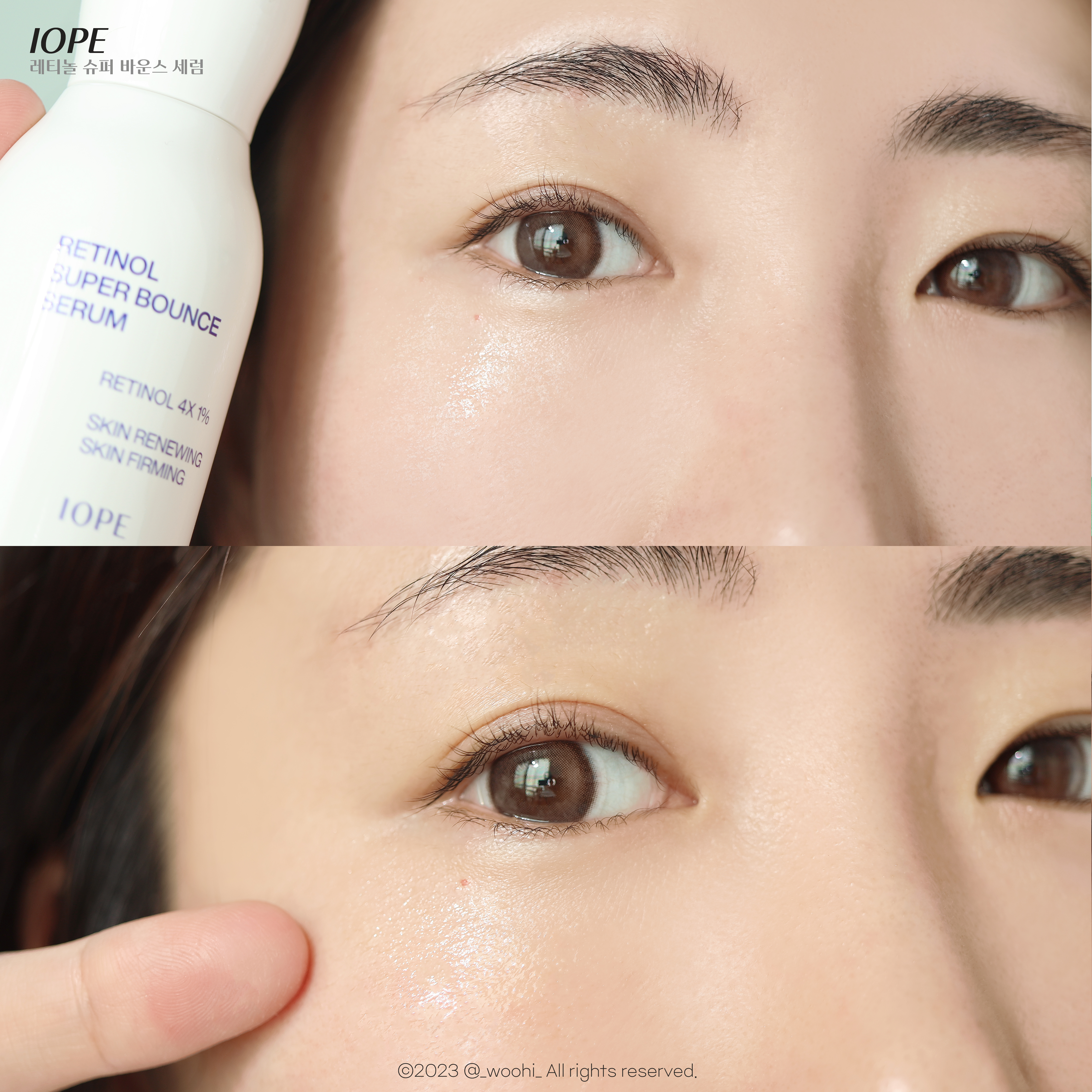 피드이미지정보-3