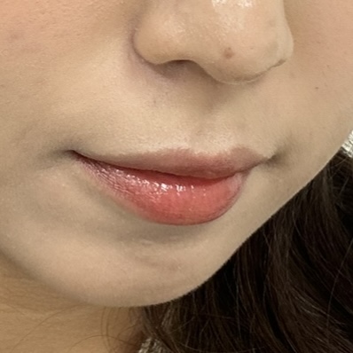 피드이미지정보-3