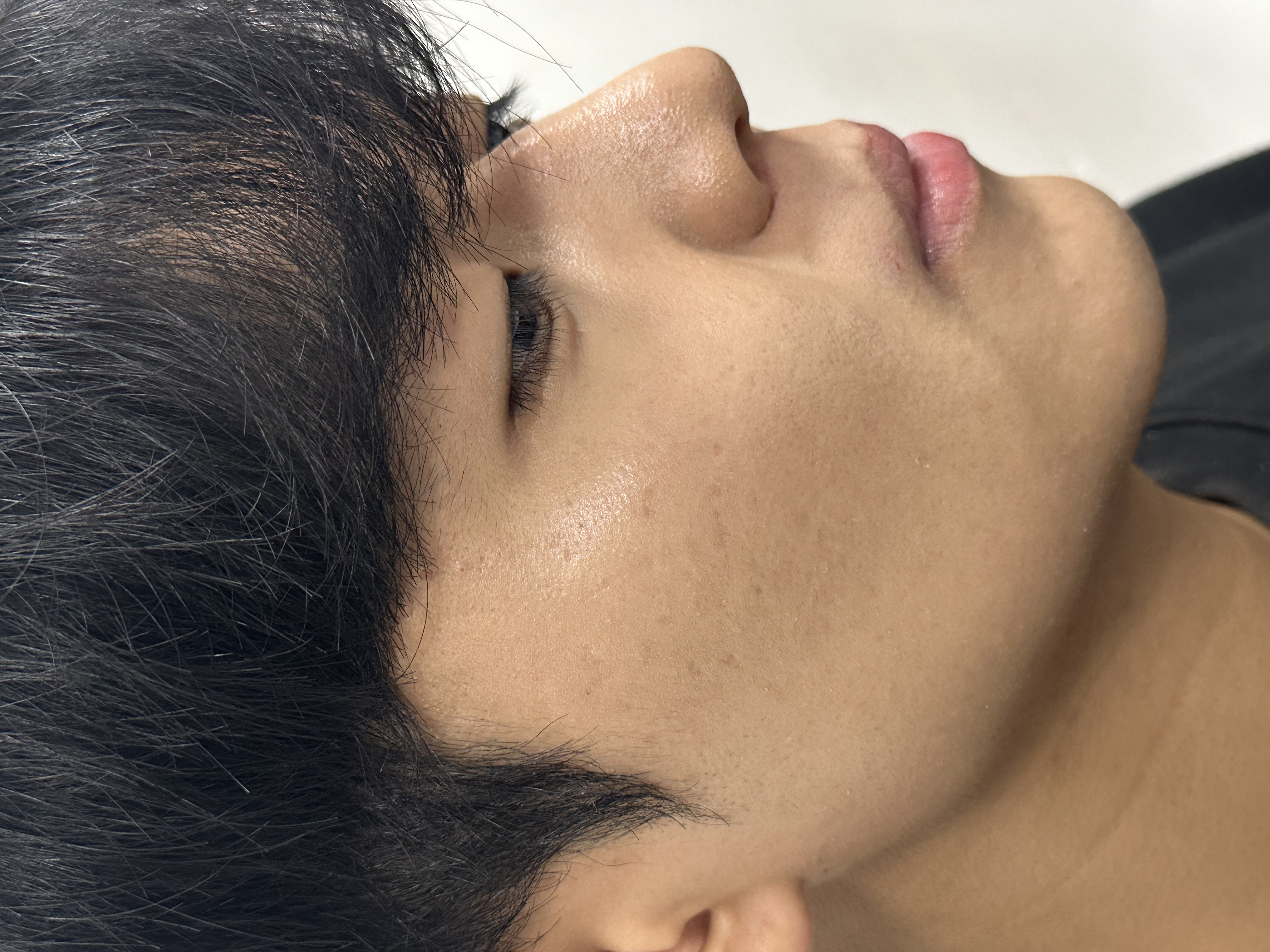 피드이미지정보-5