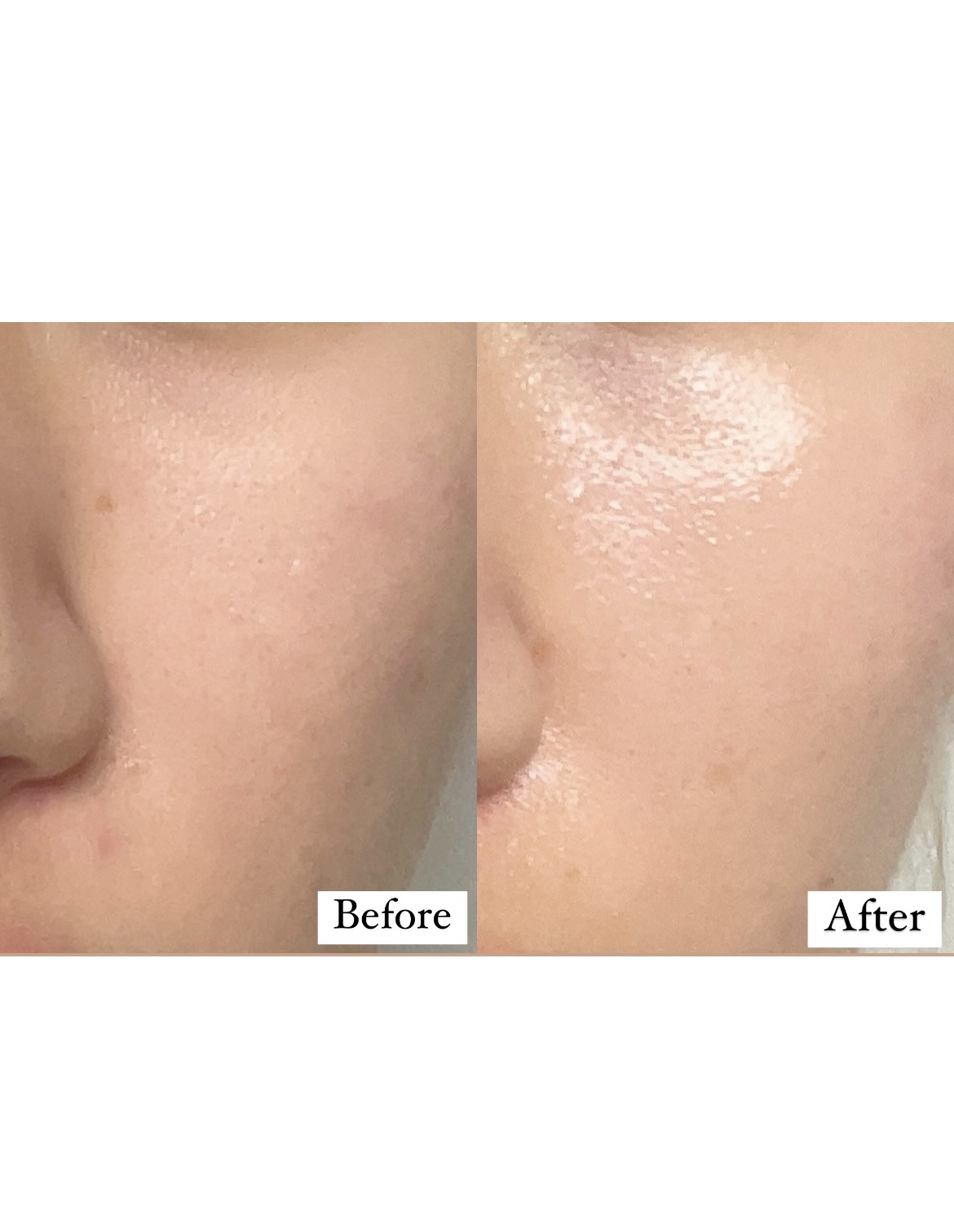 피드이미지정보-2