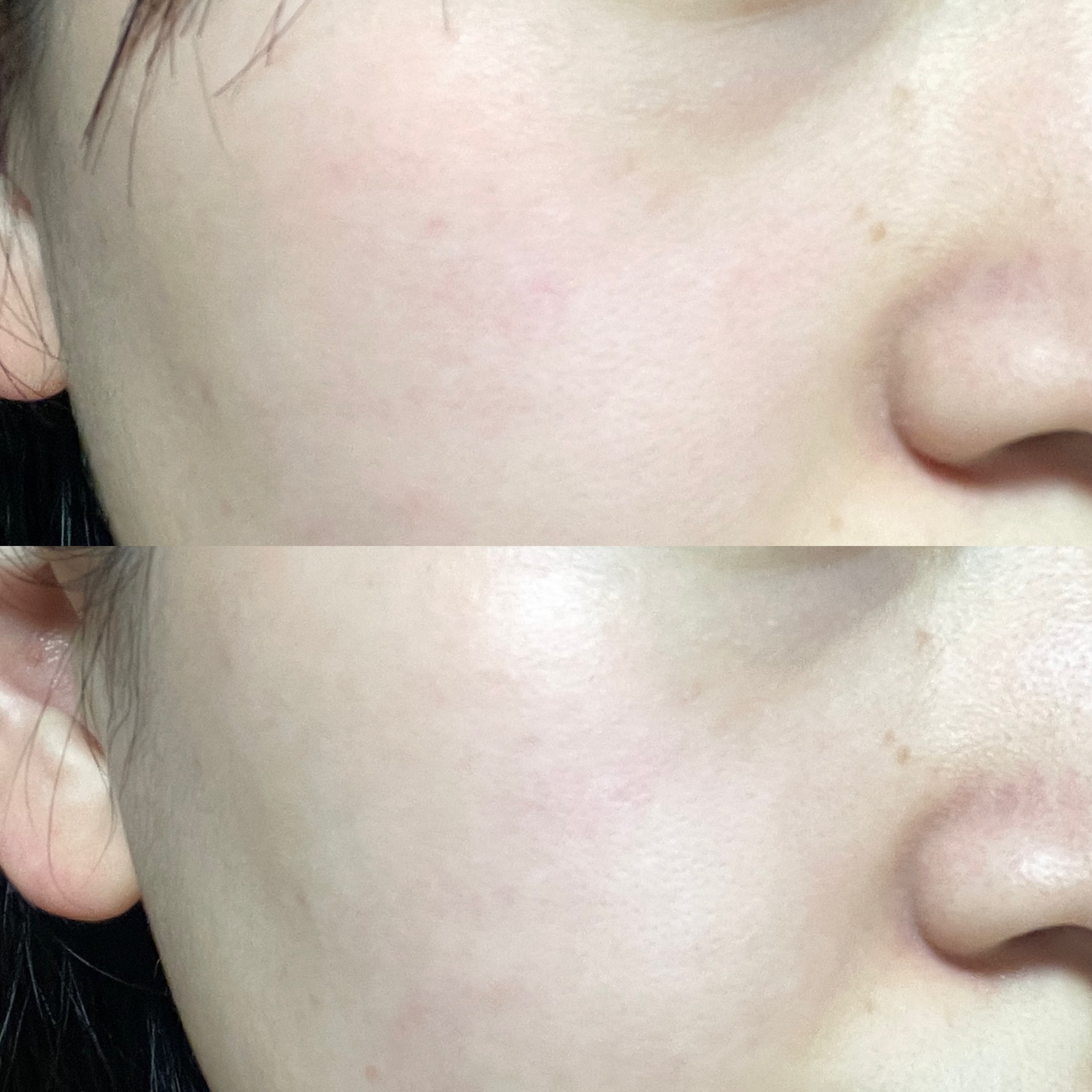 피드이미지정보-2