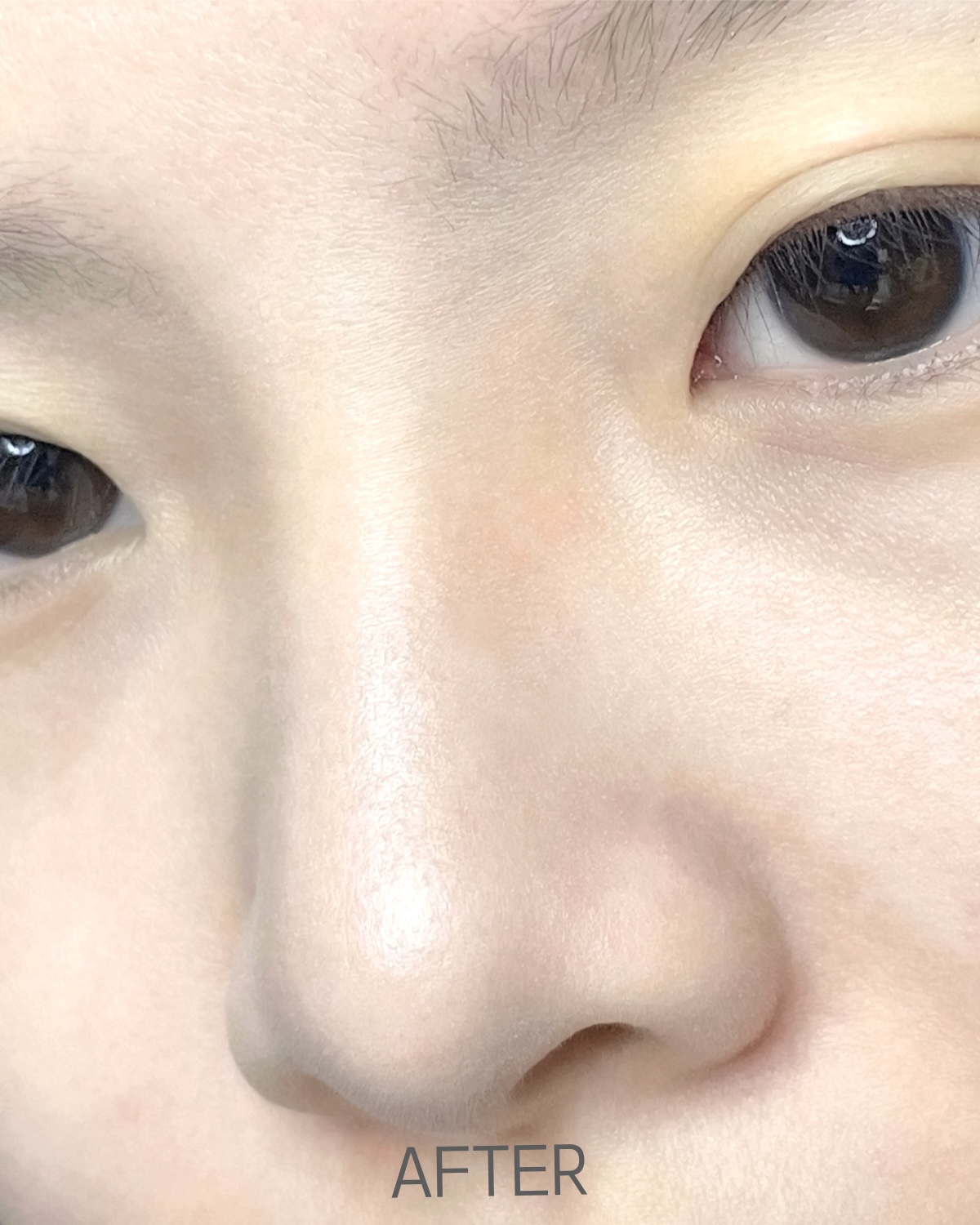 피드이미지정보-3