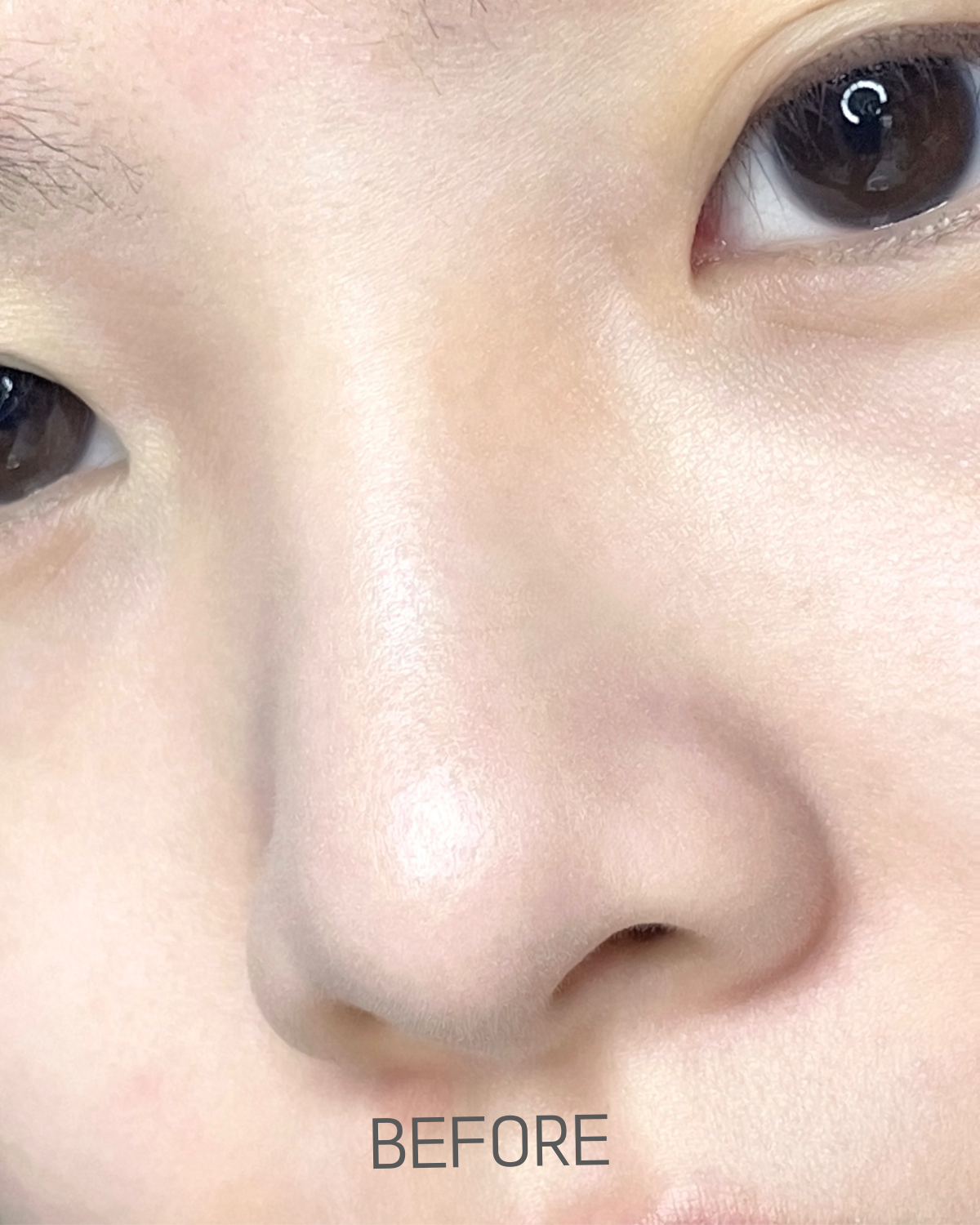 피드이미지정보-1