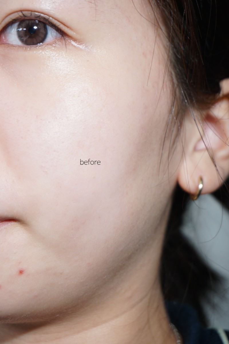 피드이미지정보-3