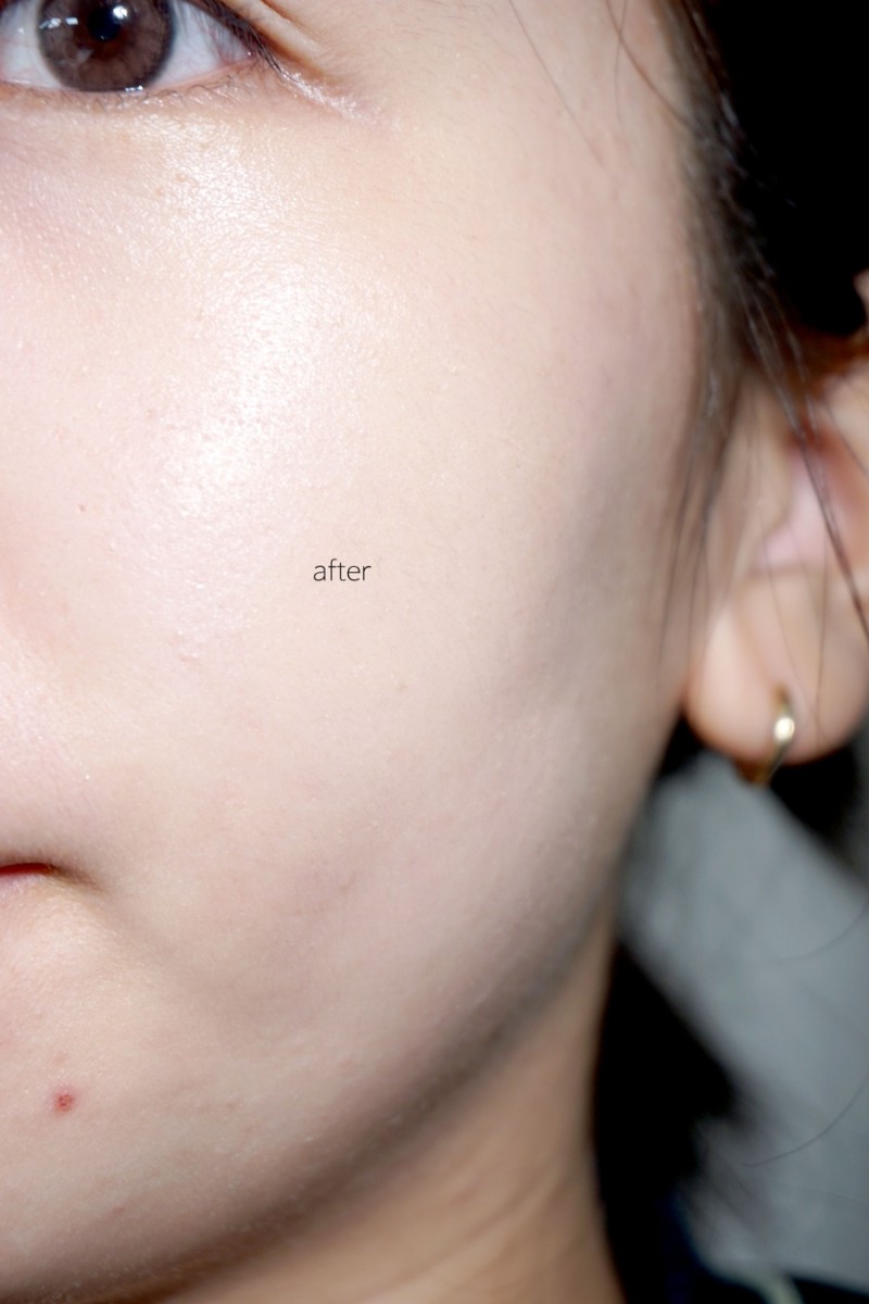 피드이미지정보-5