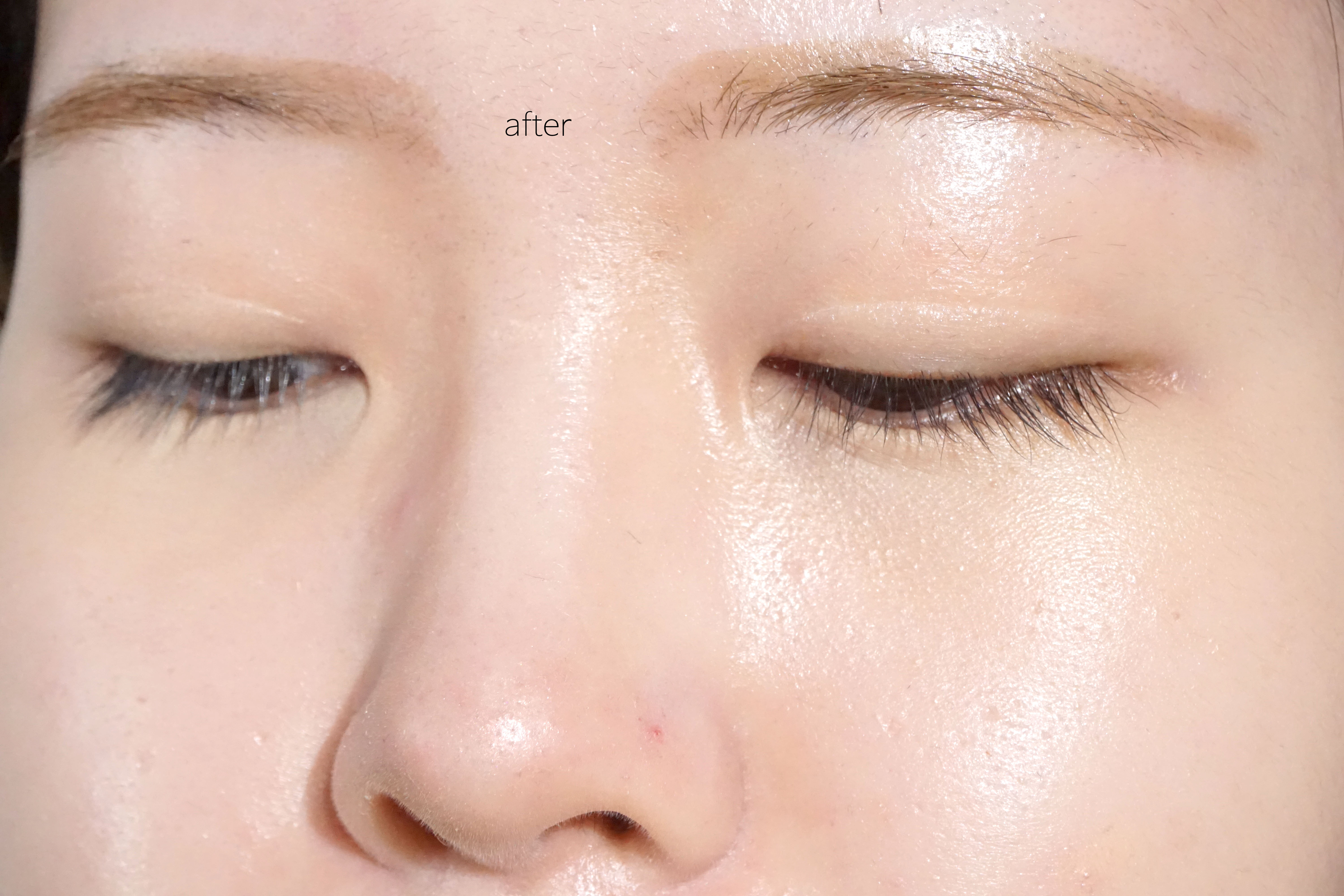 피드이미지정보-4