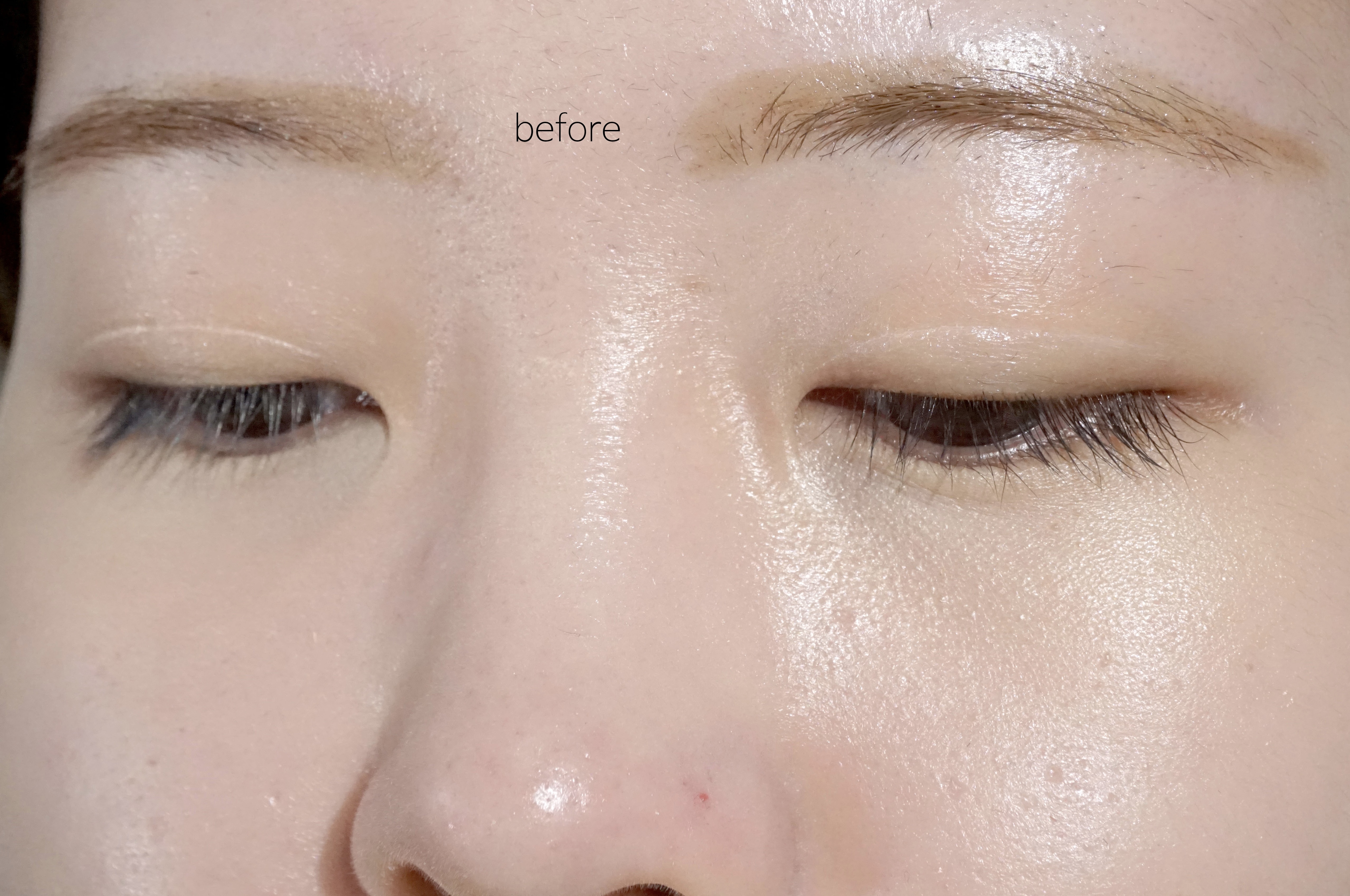 피드이미지정보-2