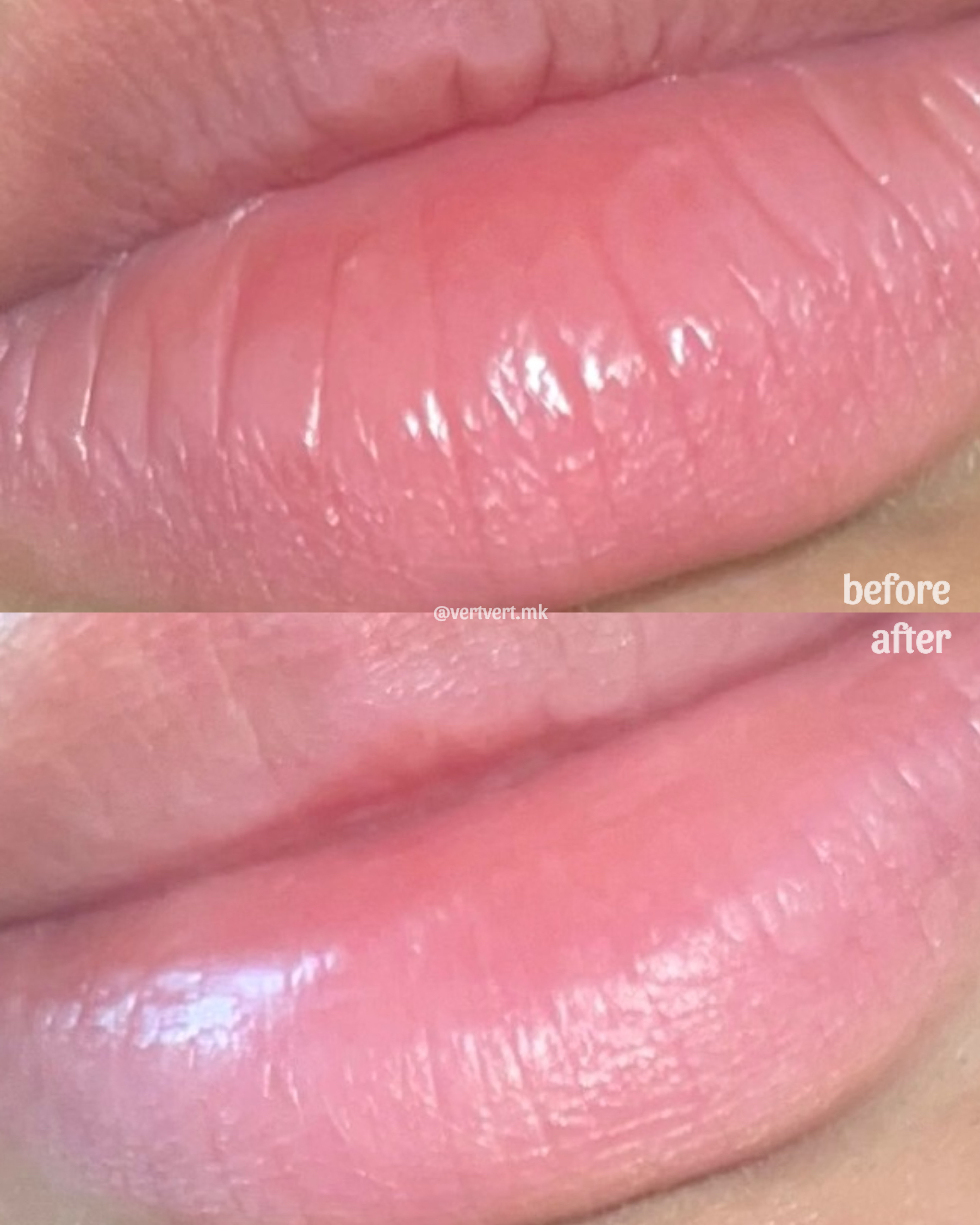 피드이미지정보-4