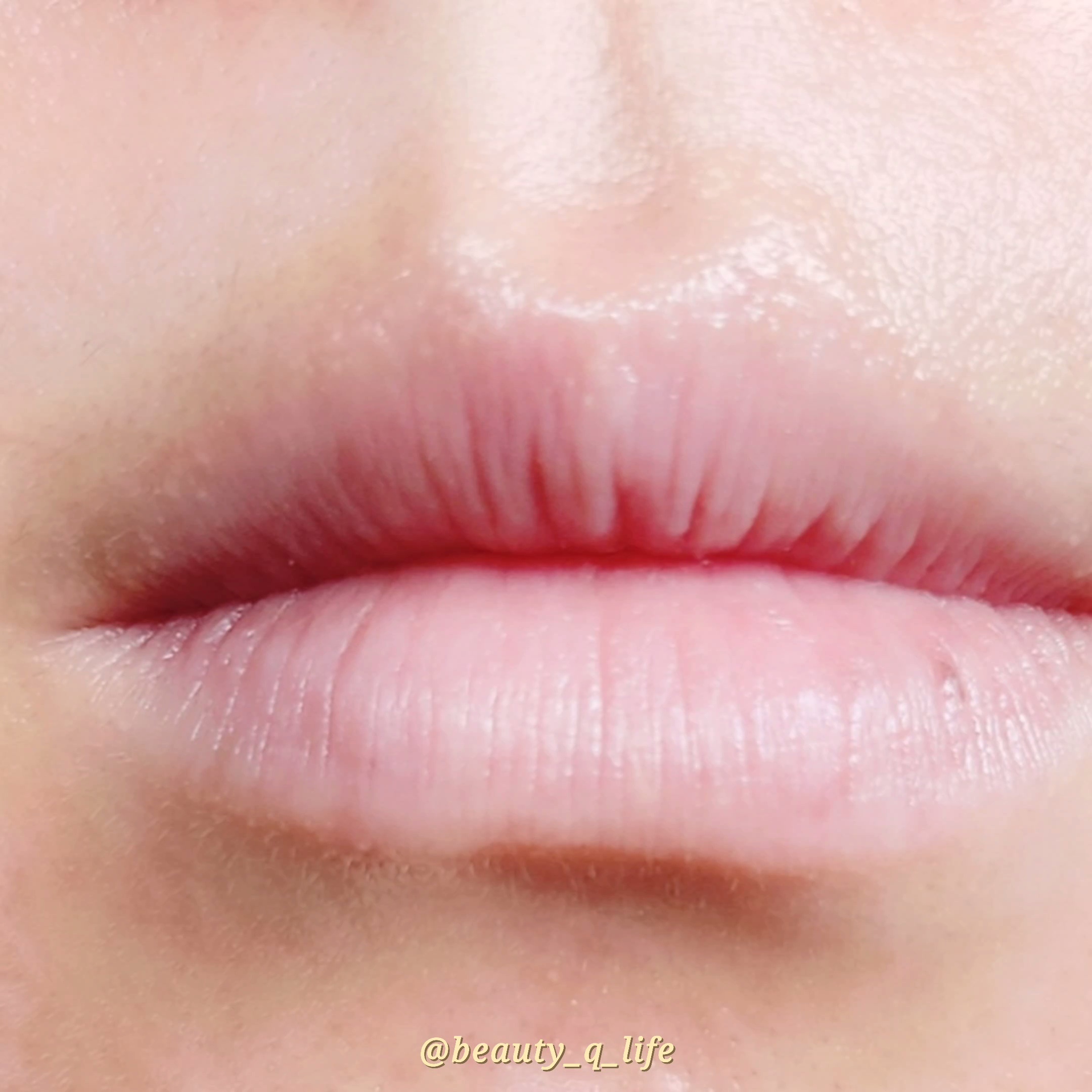 피드이미지정보-2