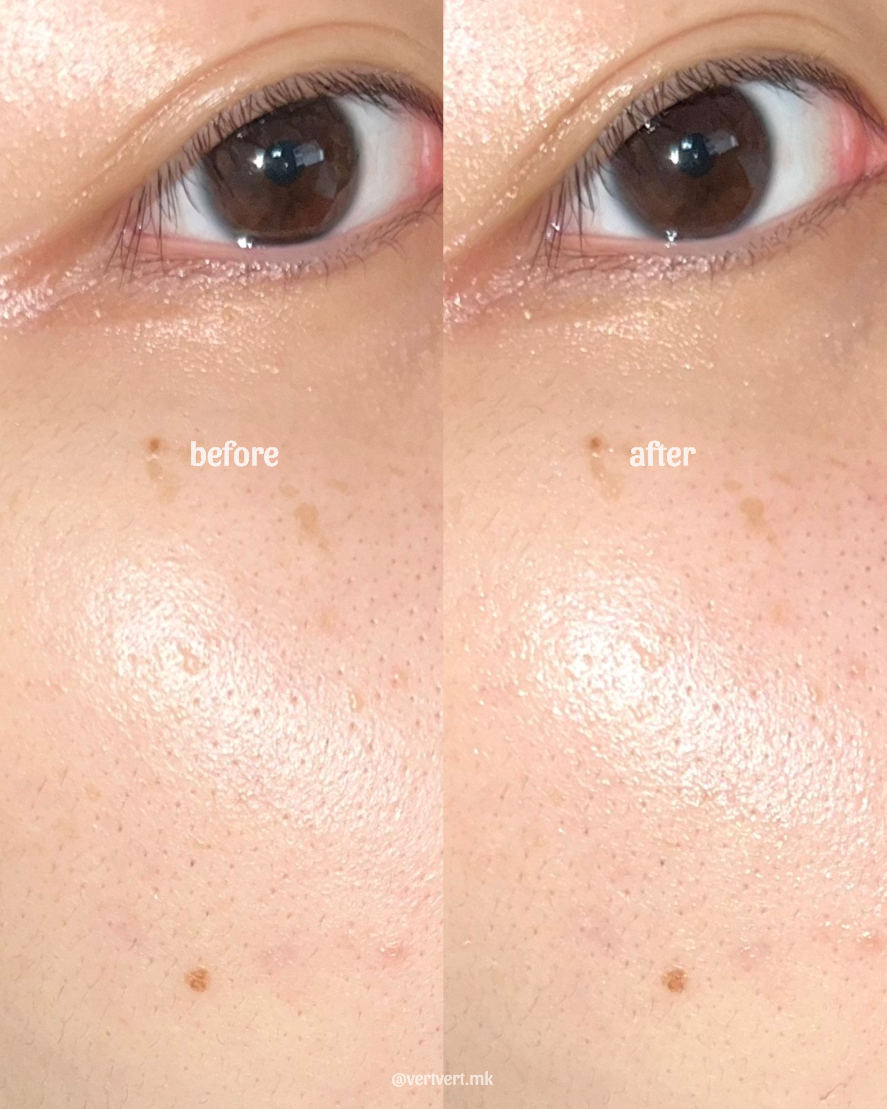 피드이미지정보-5