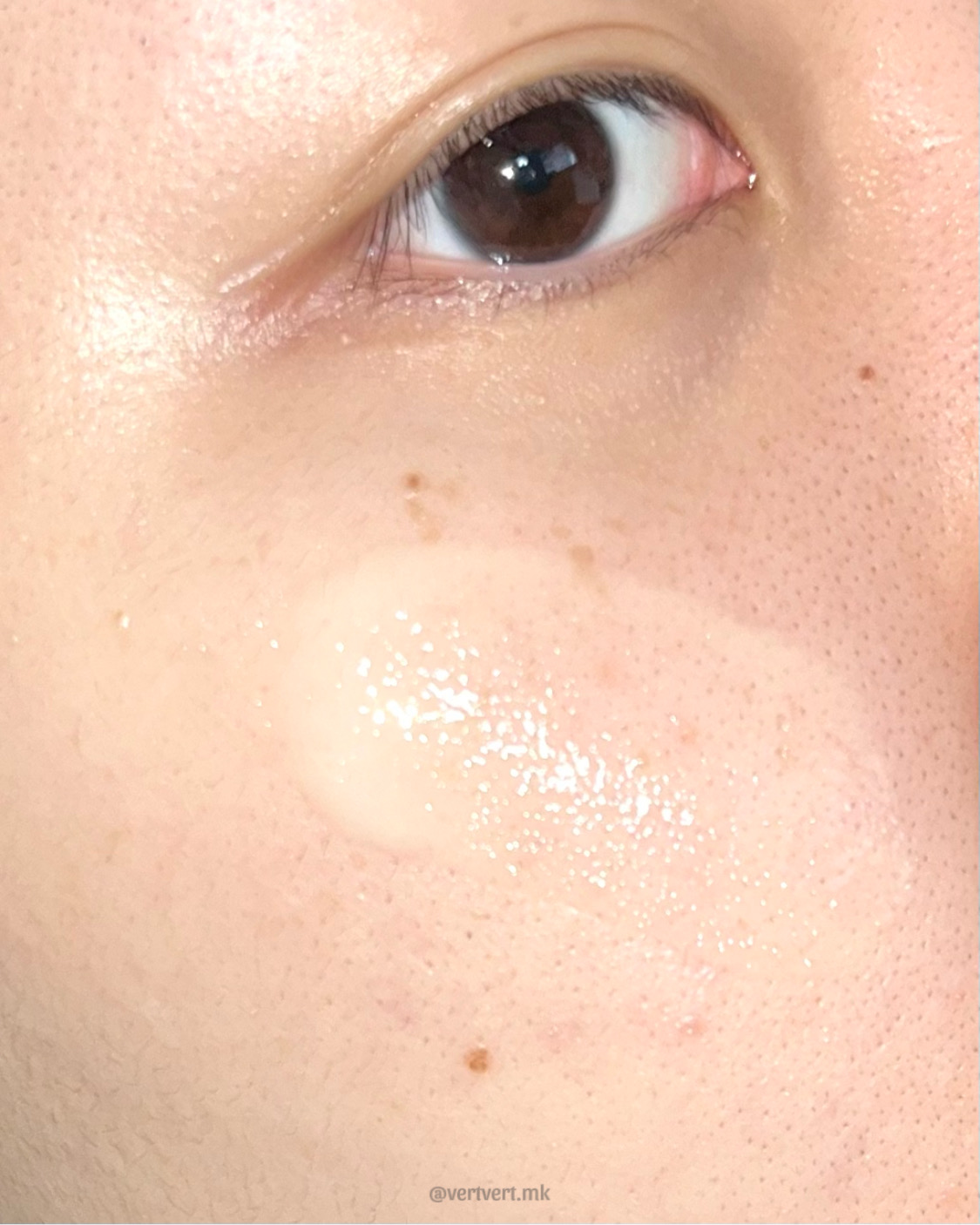 피드이미지정보-4