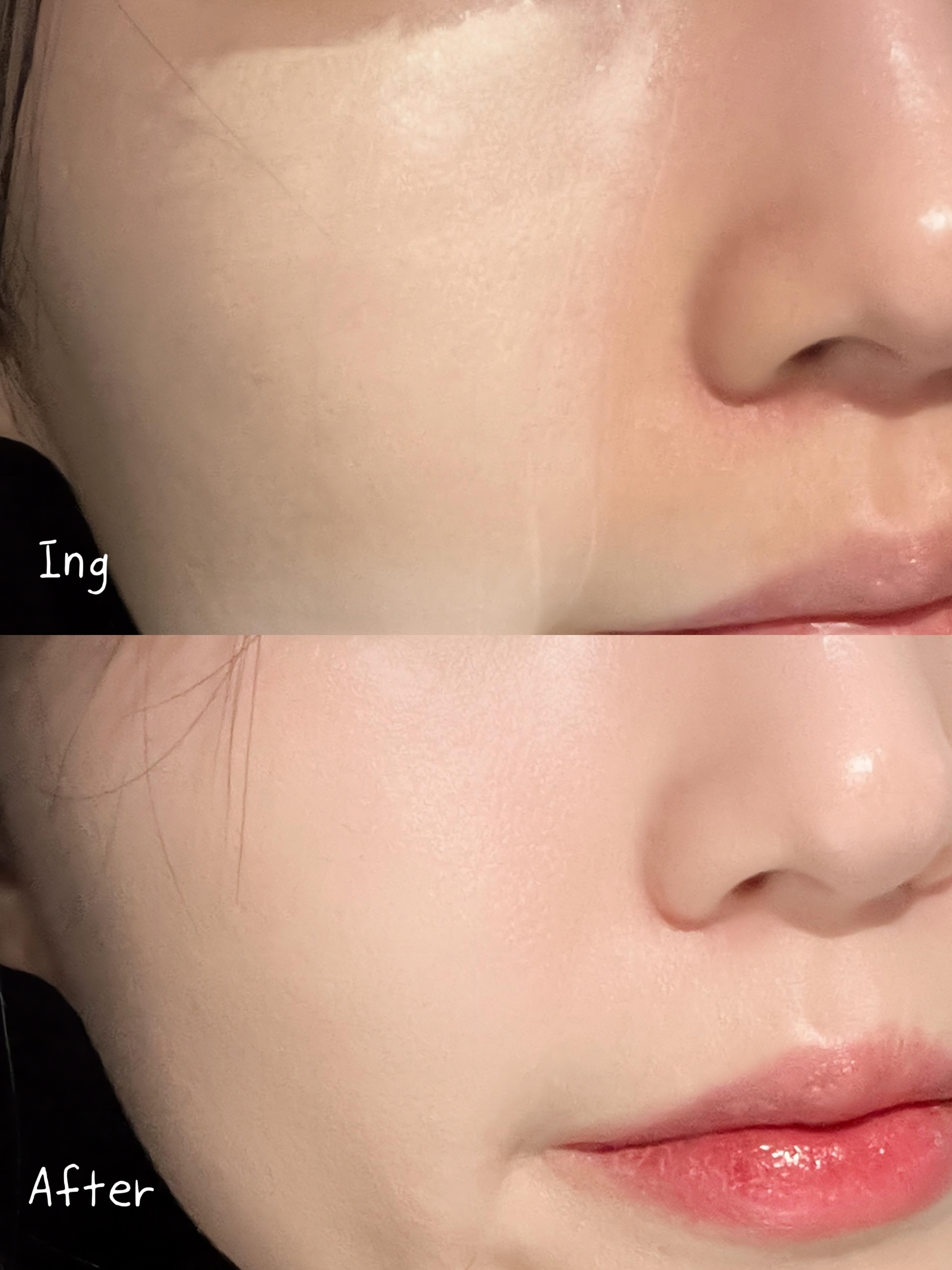 피드이미지정보-5