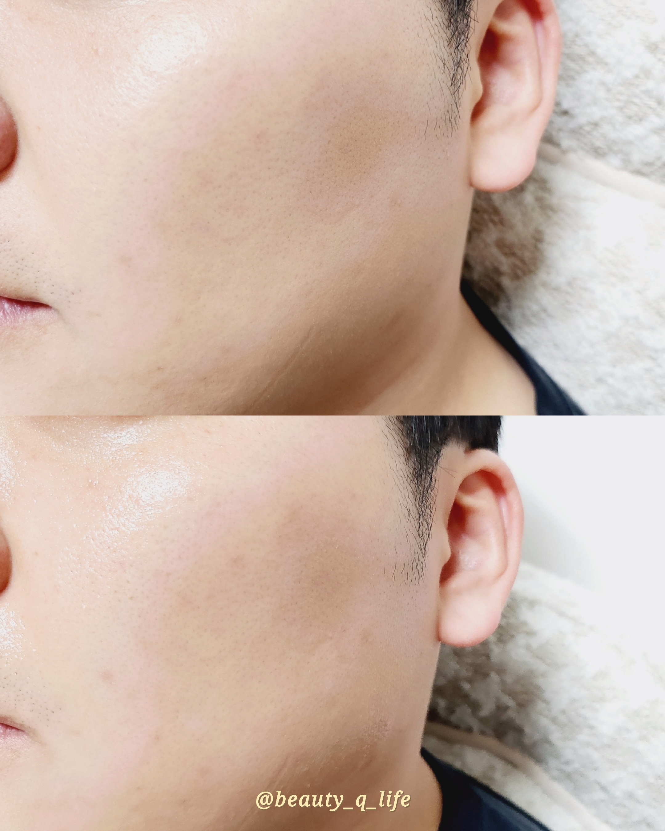 피드이미지정보-0