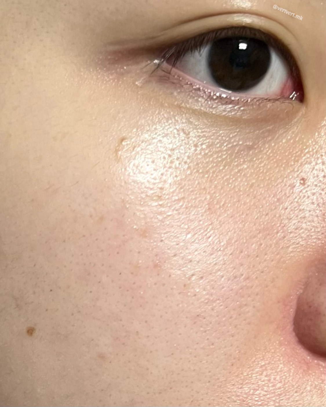 피드이미지정보-4