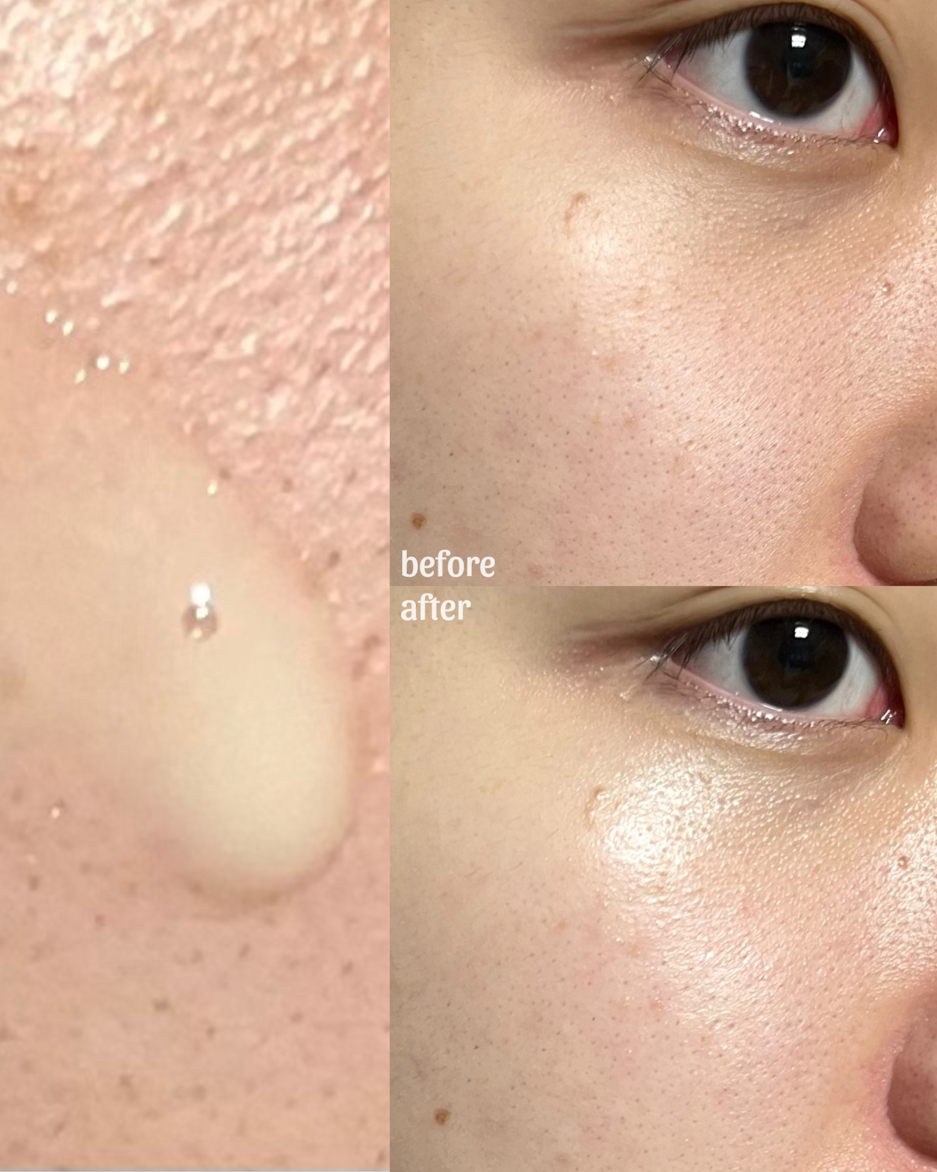 피드이미지정보-0