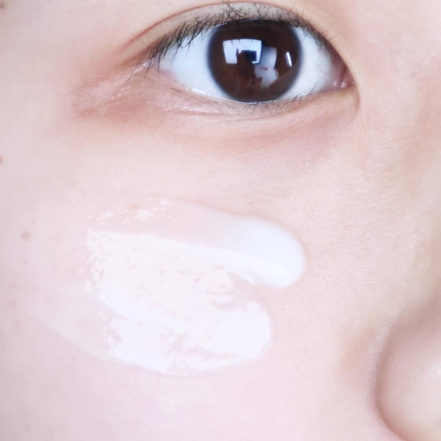 피드이미지정보-5